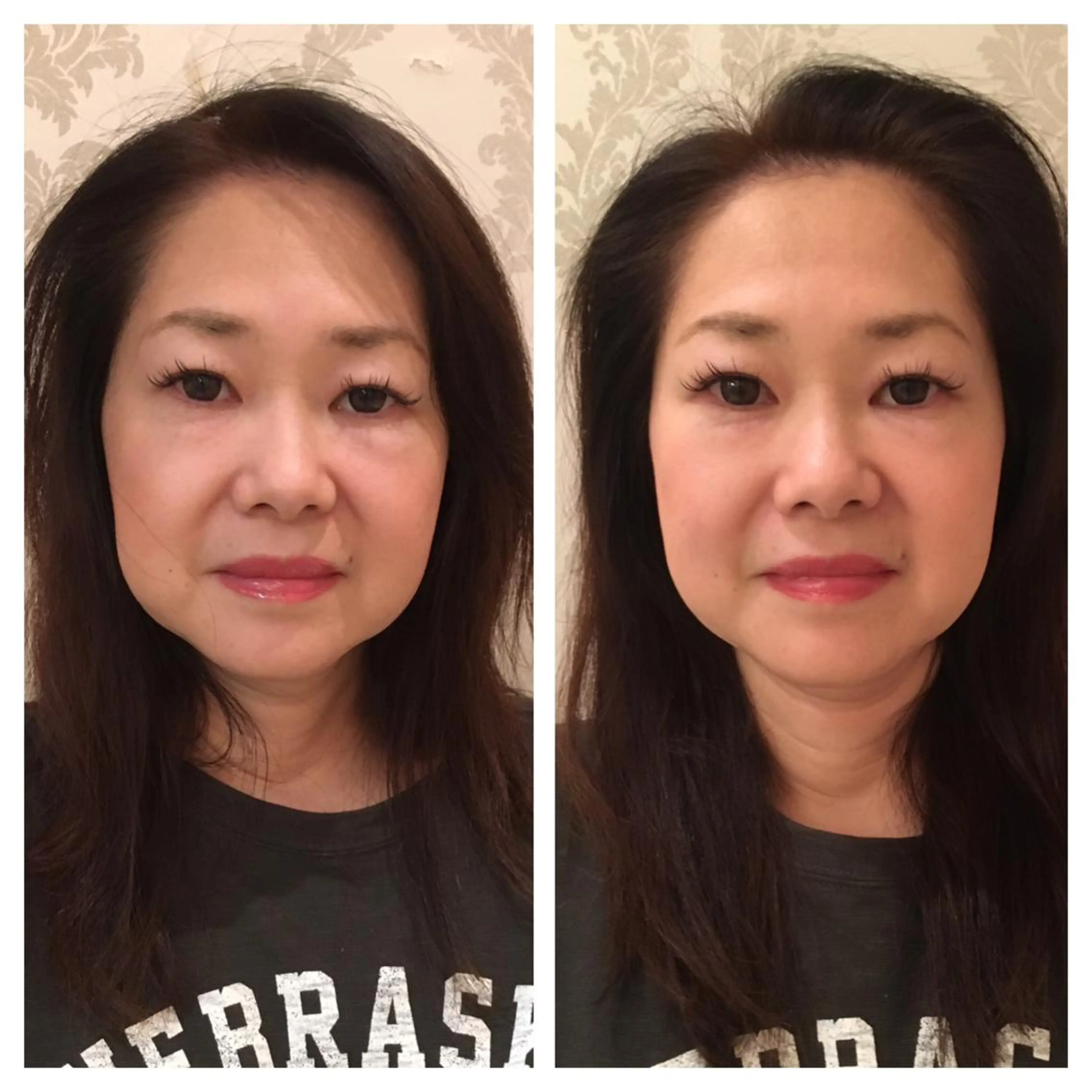 伊藤 かなえのエステ・リラクイメージ