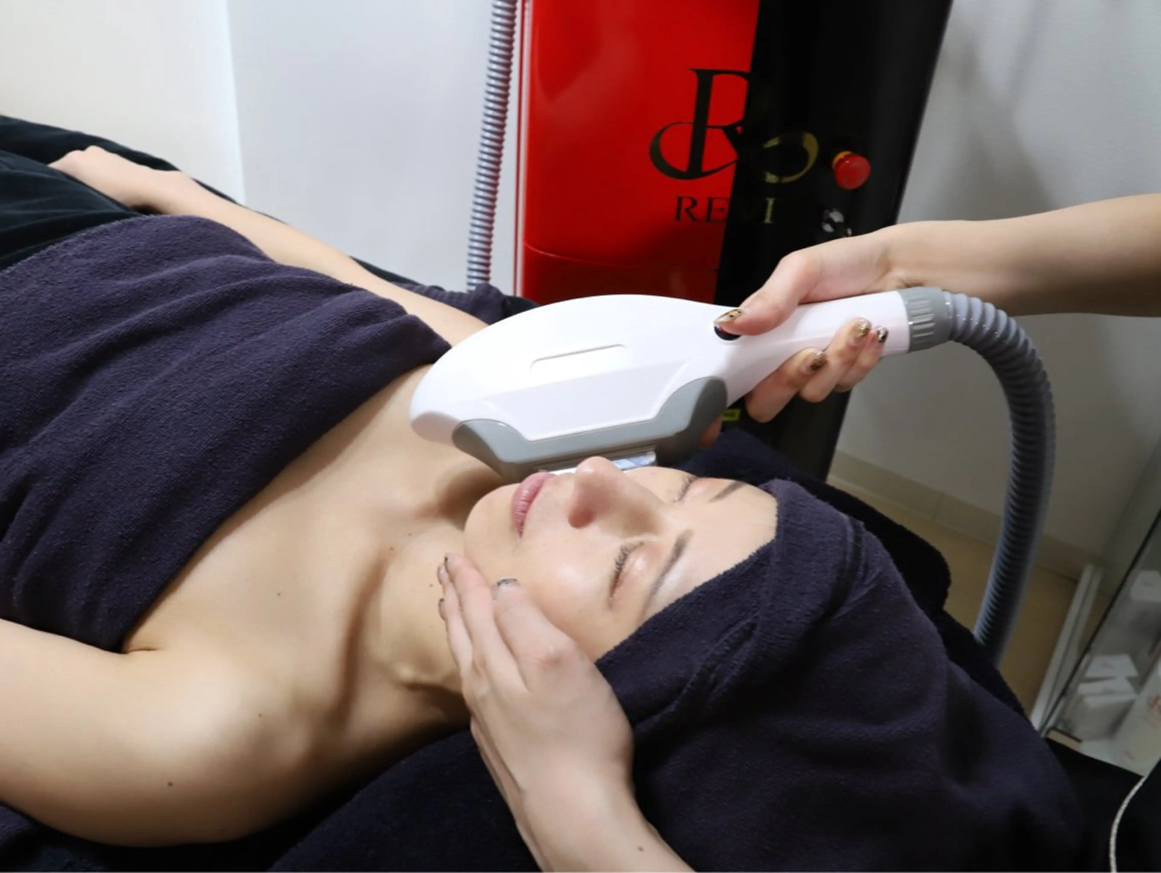 【フェイシャル脱毛】毛周期関係なし👏🩵の写真