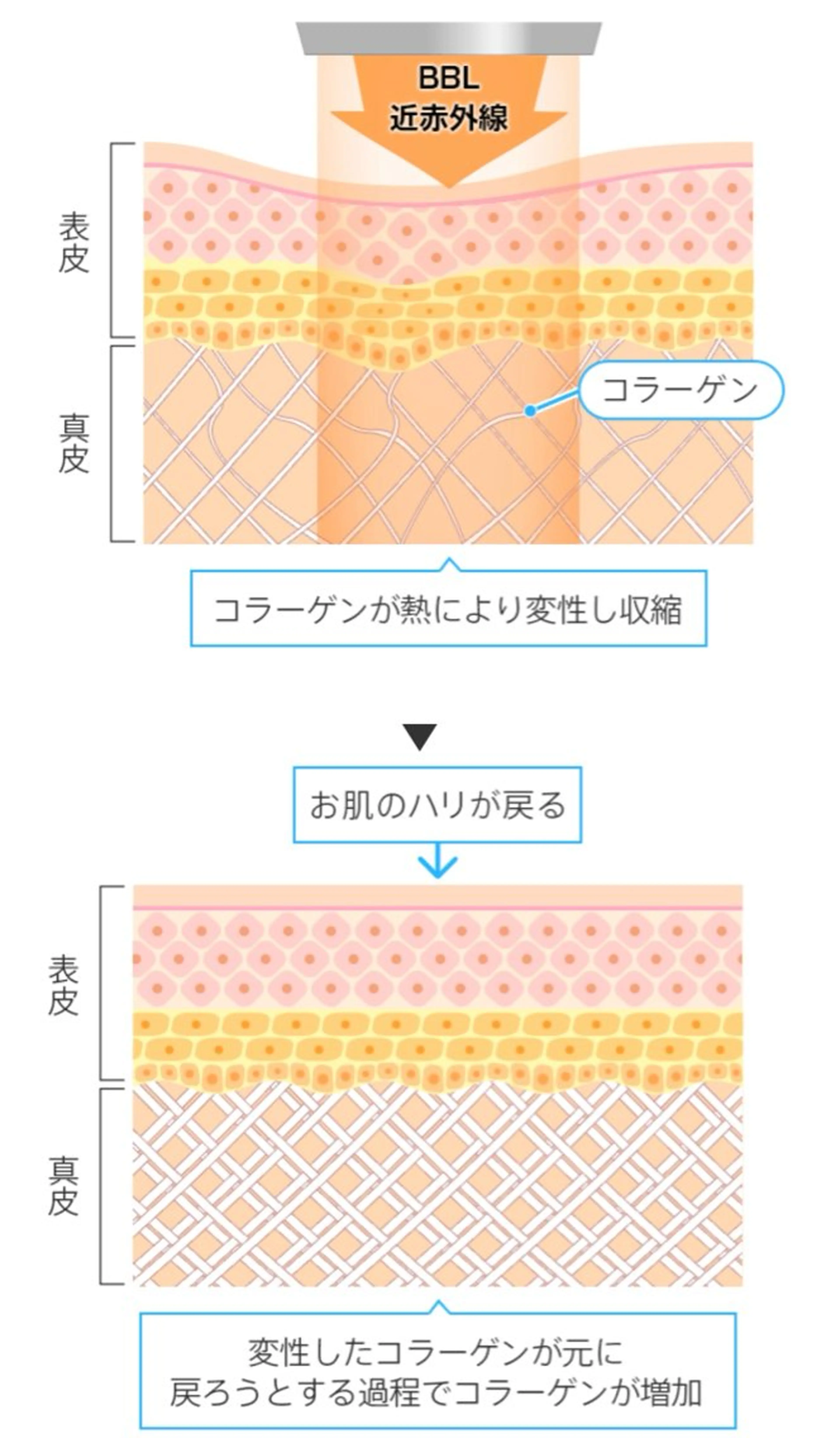 メンズ 脱毛サロン BRIDGE橋本のエステ・リラクイメージ