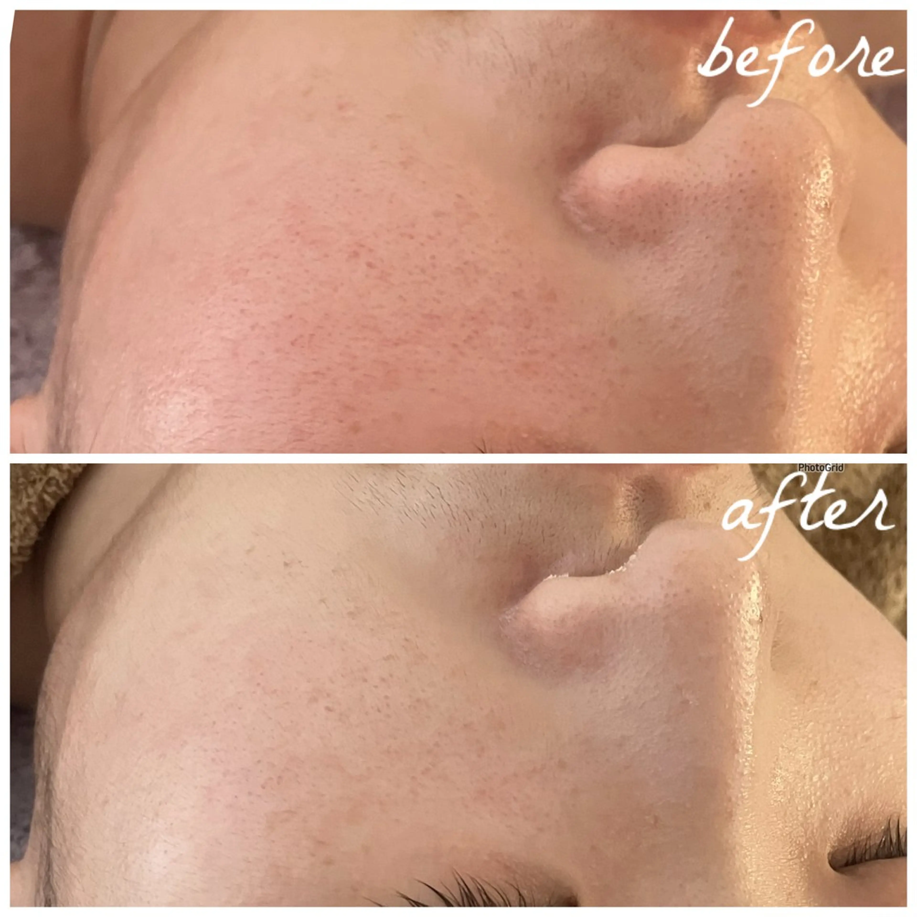 メンズ エステ メナード岐阜市茜部 杉浦のエステ・リラクイメージ