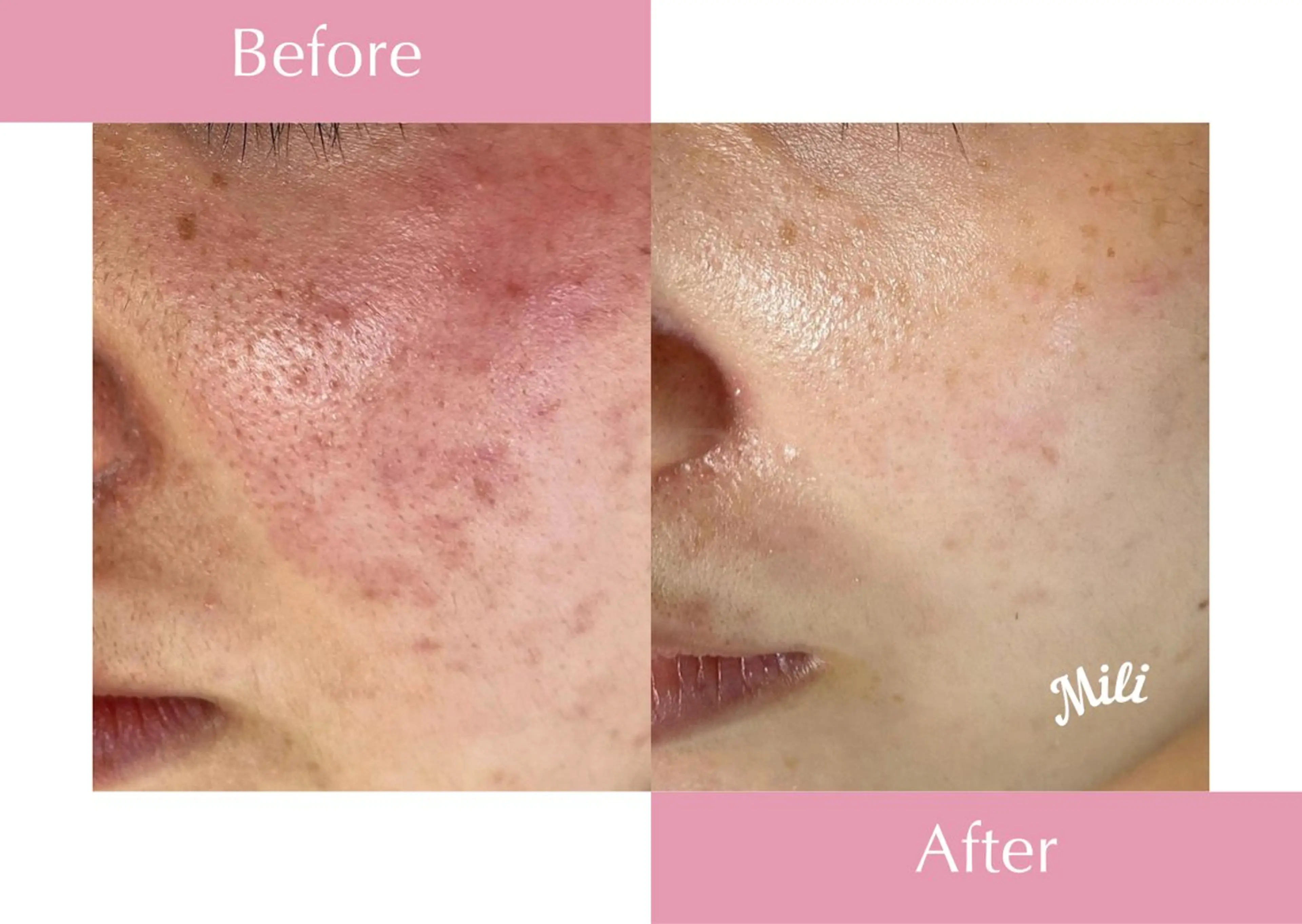 エステ mili 千葉店のエステ・リラクイメージ