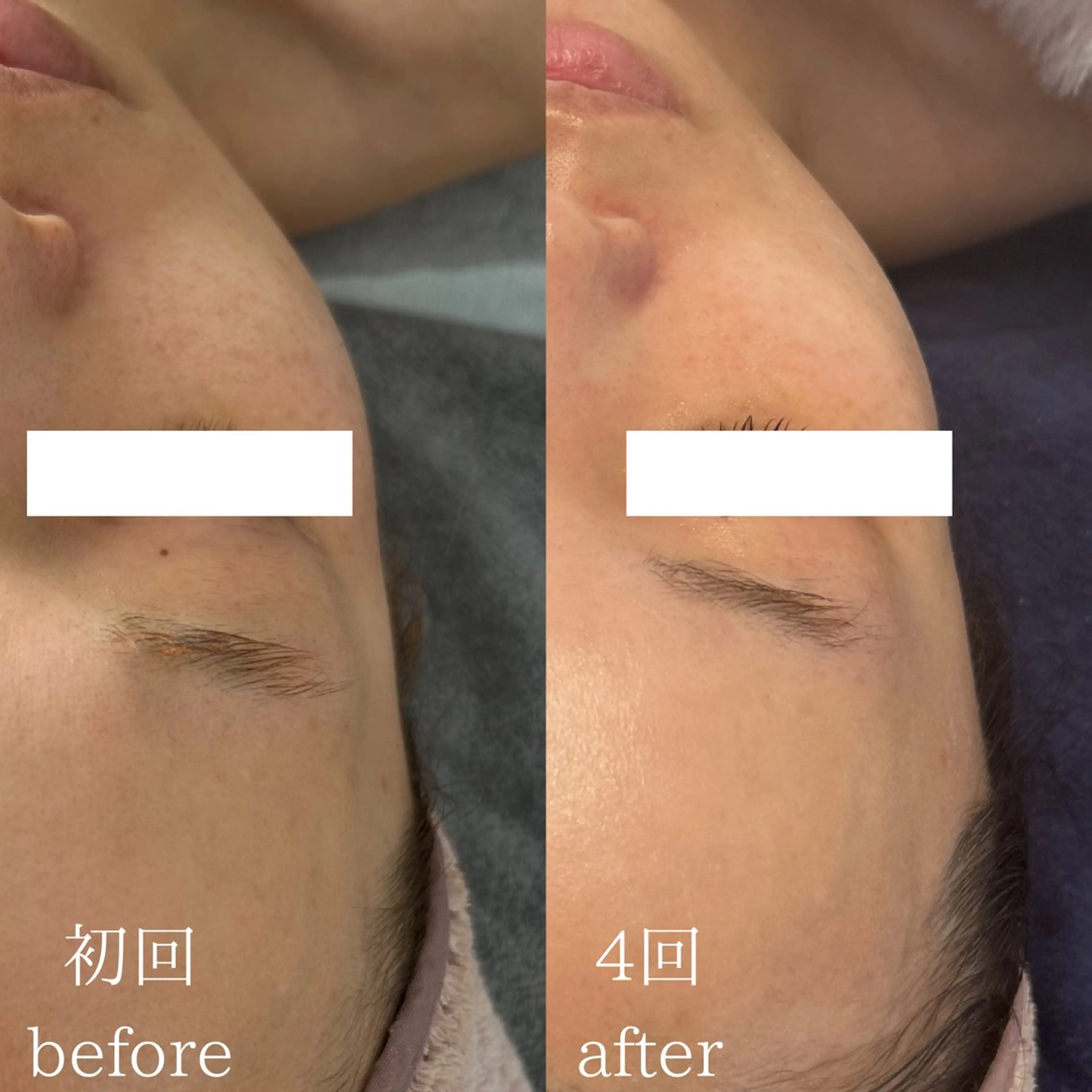 エステ Le cherienのエステ・リラクイメージ