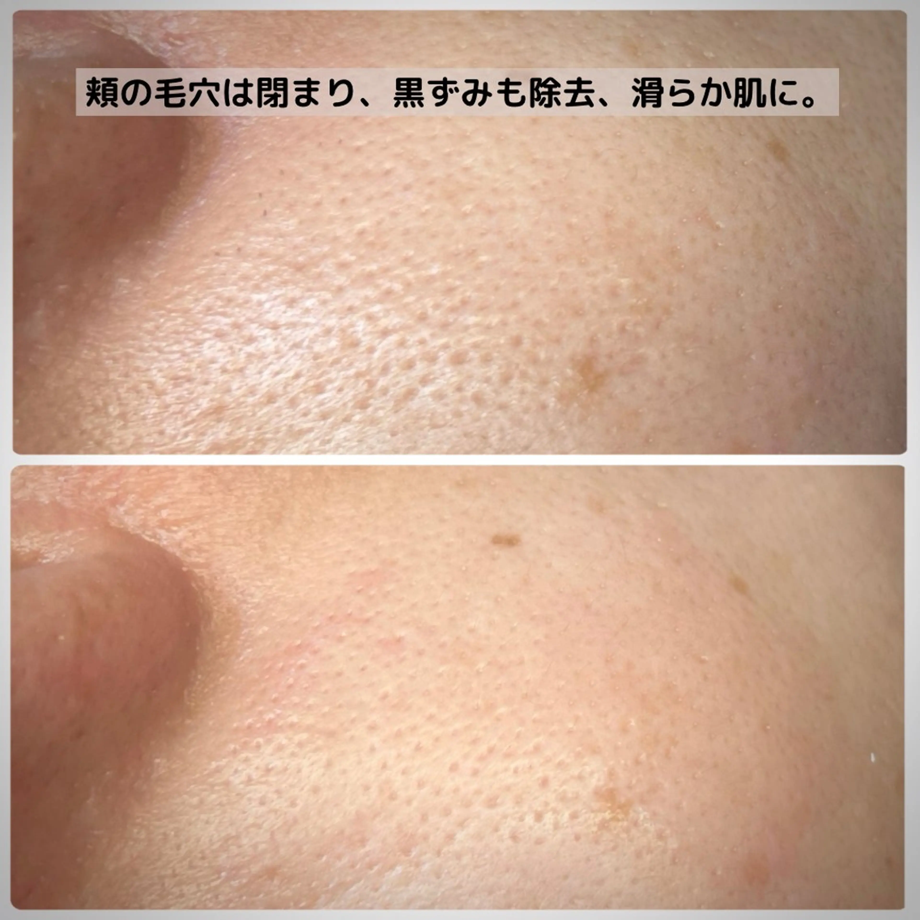 エステ Muqu. 毛穴サロンのエステ・リラクイメージ