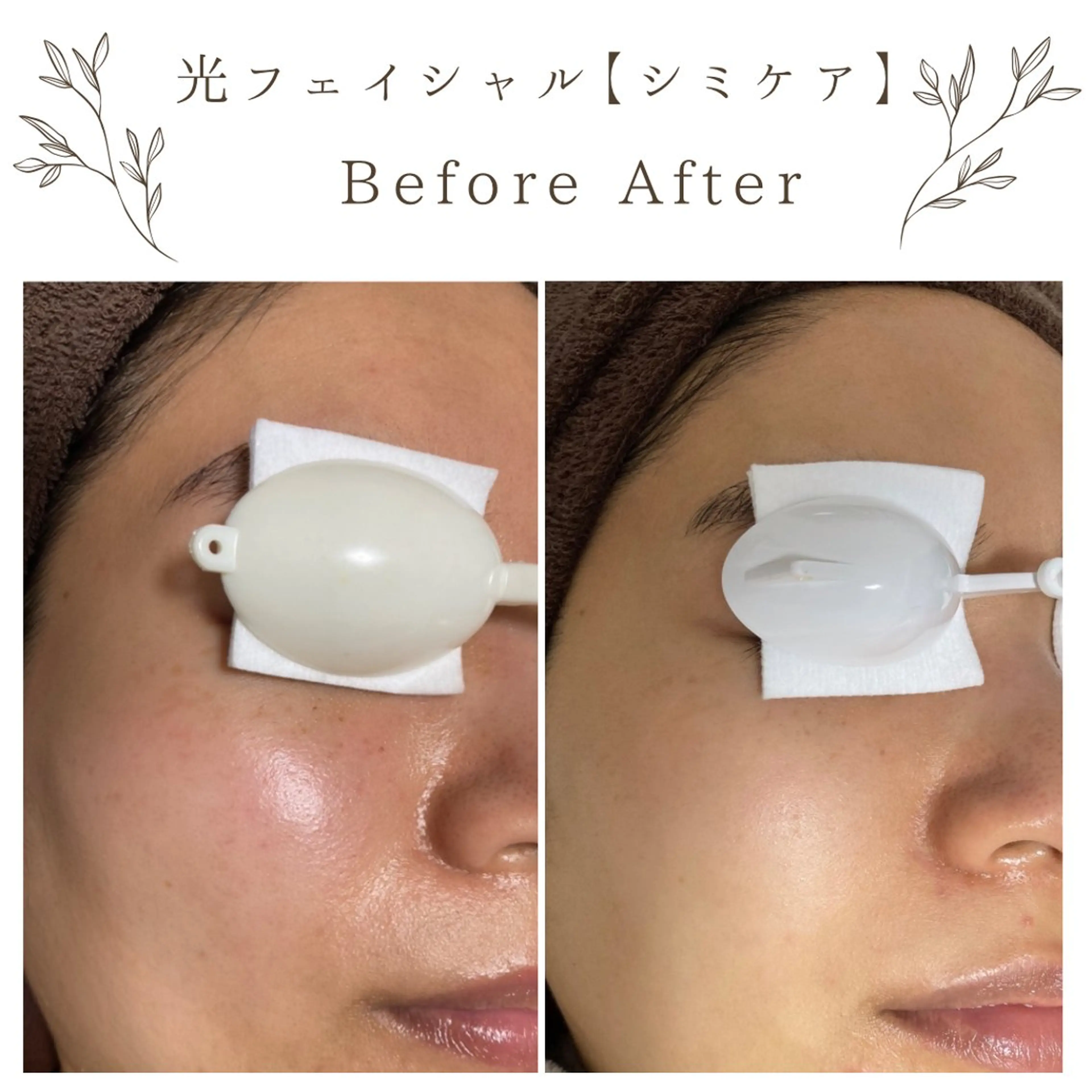 な ぎのエステ・リラクイメージ