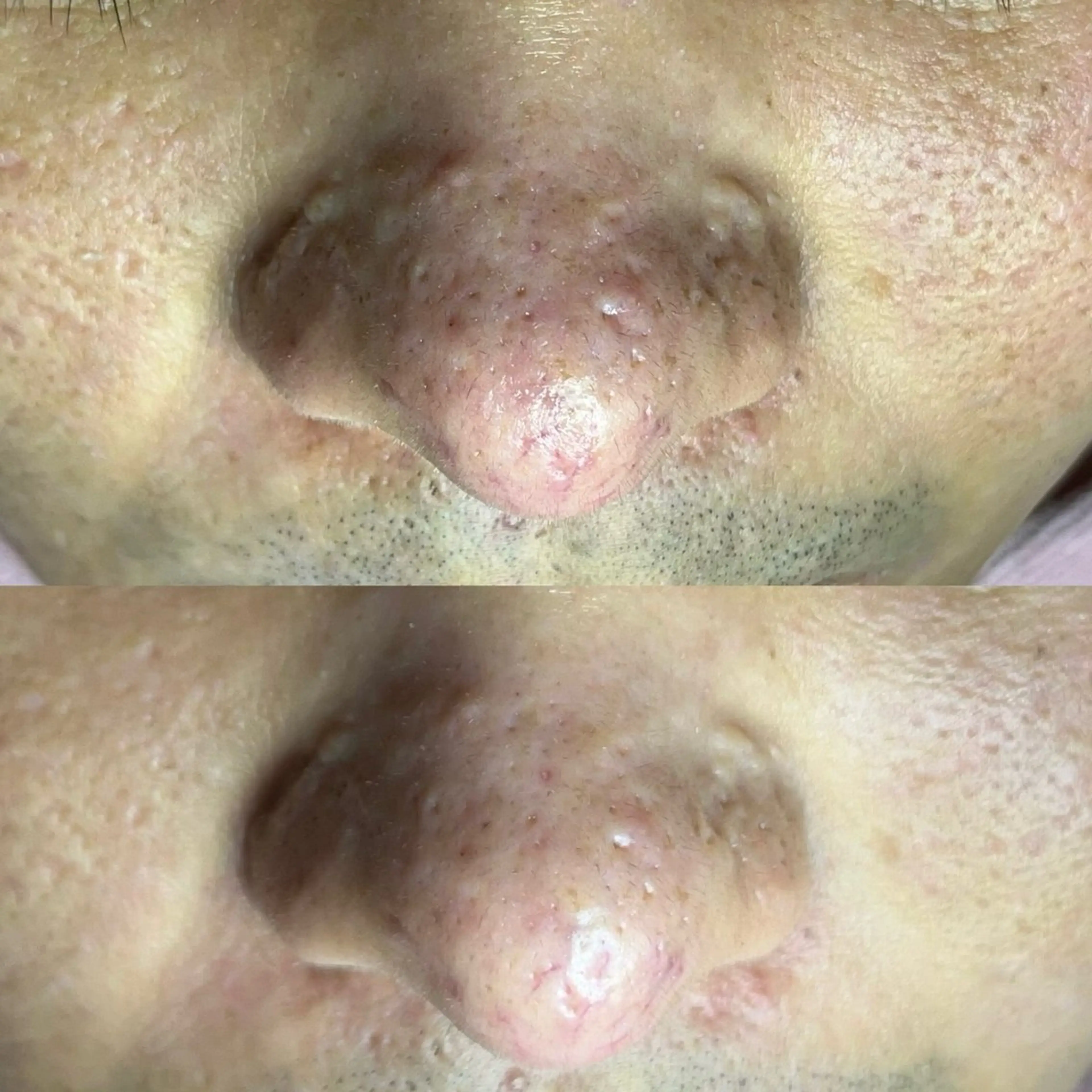 毛穴ケア・ヘッドスパ サロンSHINYのエステ・リラクイメージ