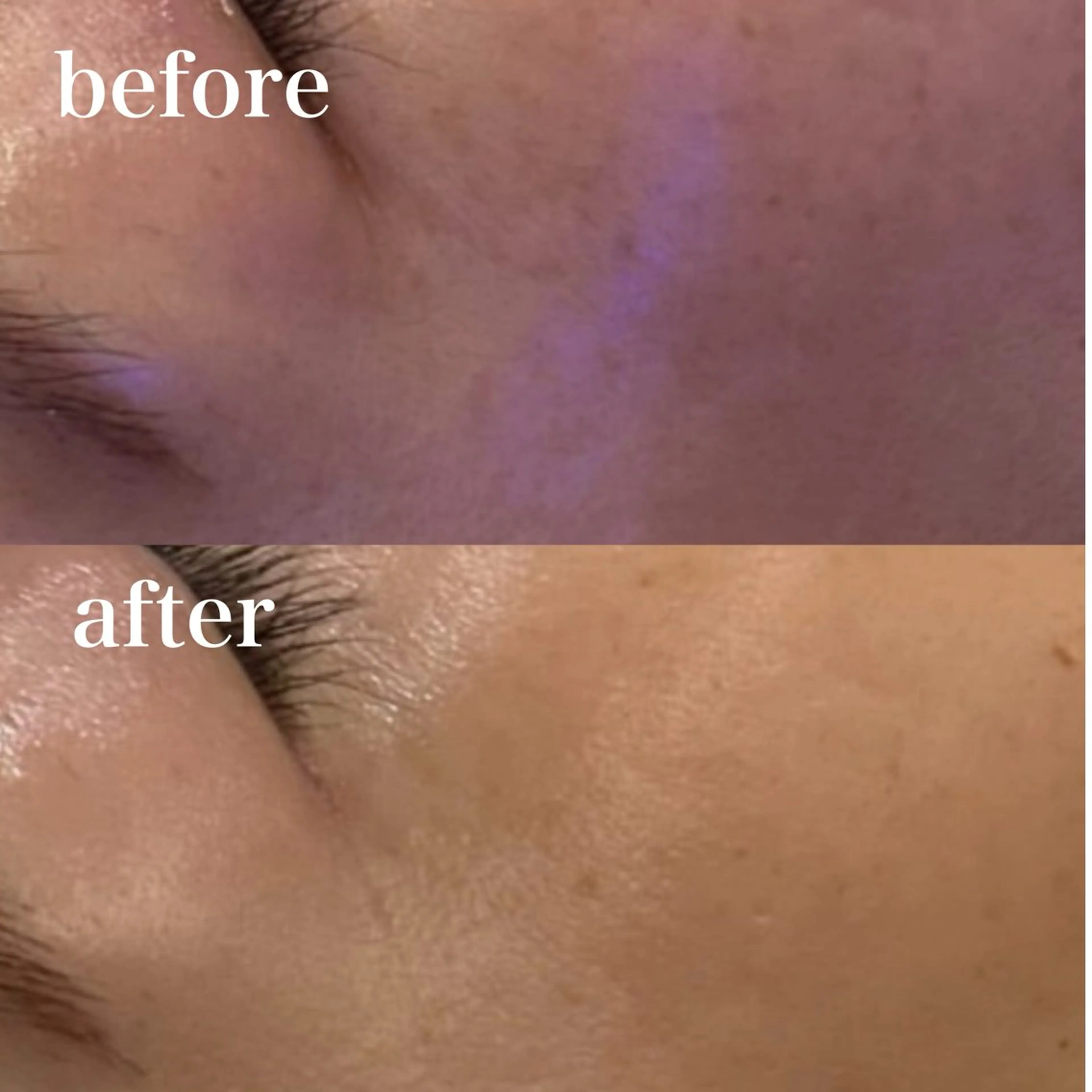 unsui spa 渋谷区神泉のエステ・リラクイメージ