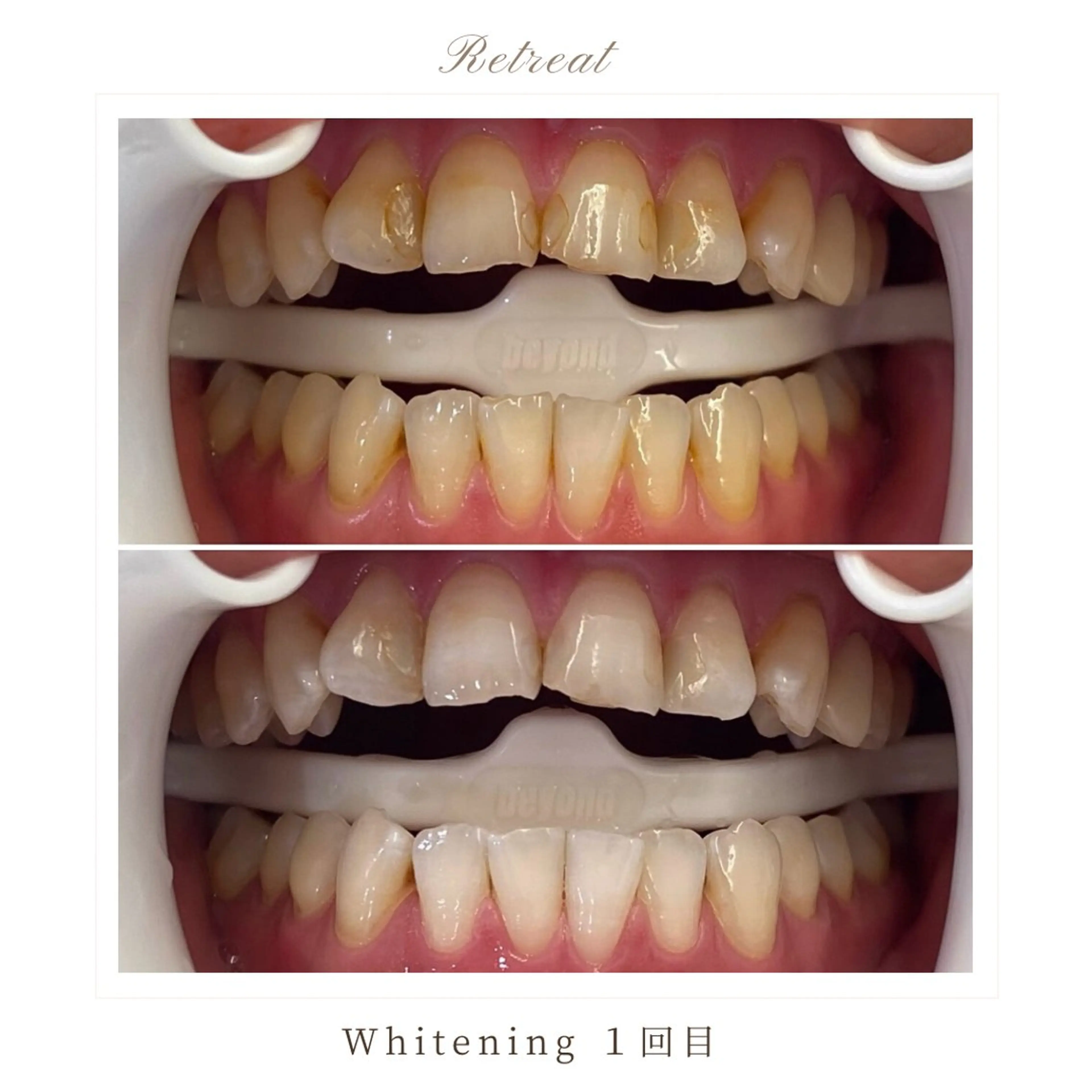 歯科医院提携 Retreatのエステ・リラクイメージ