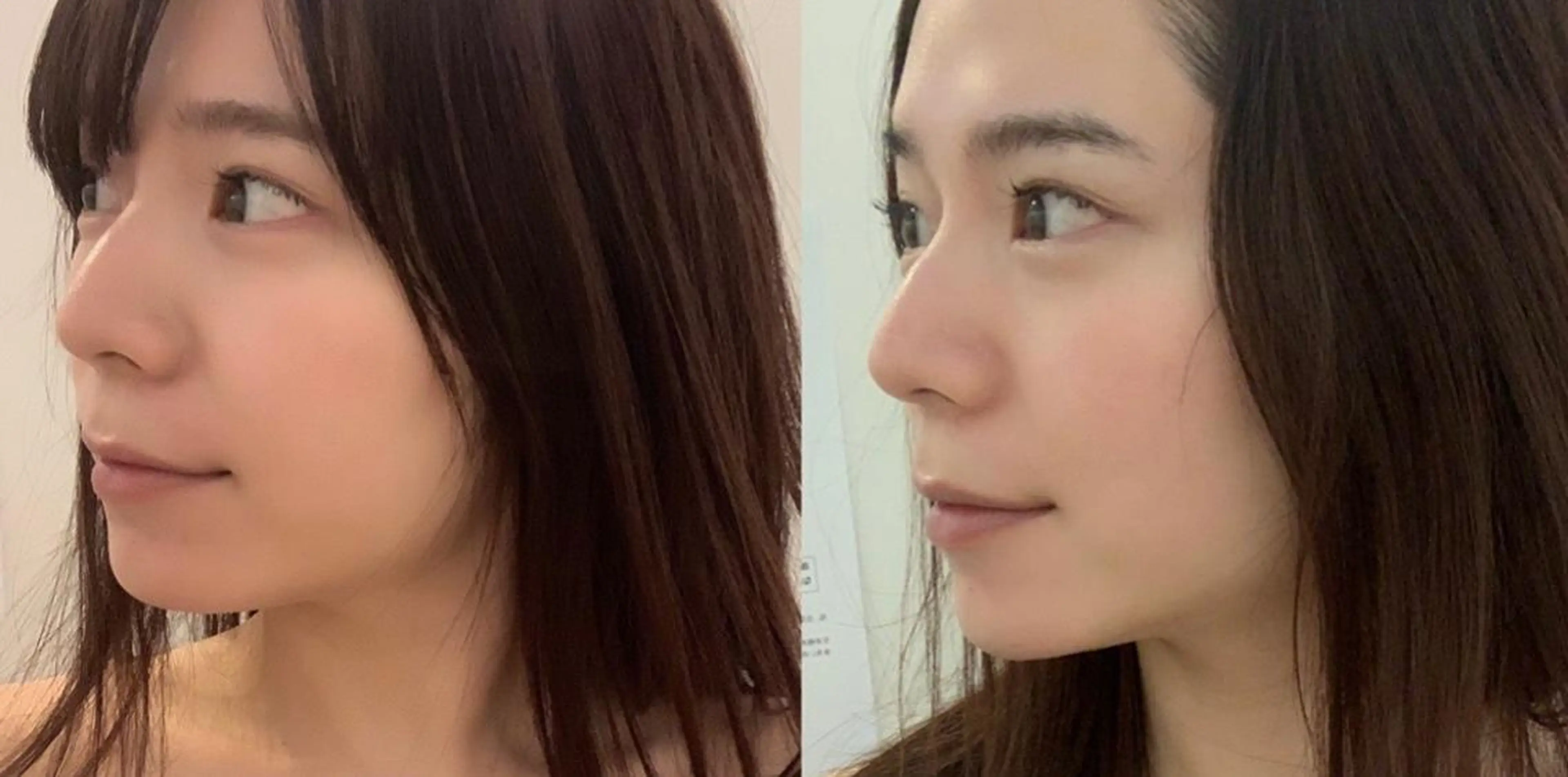 韓国/ピーリング 毛穴洗浄/POLAのエステ・リラクイメージ