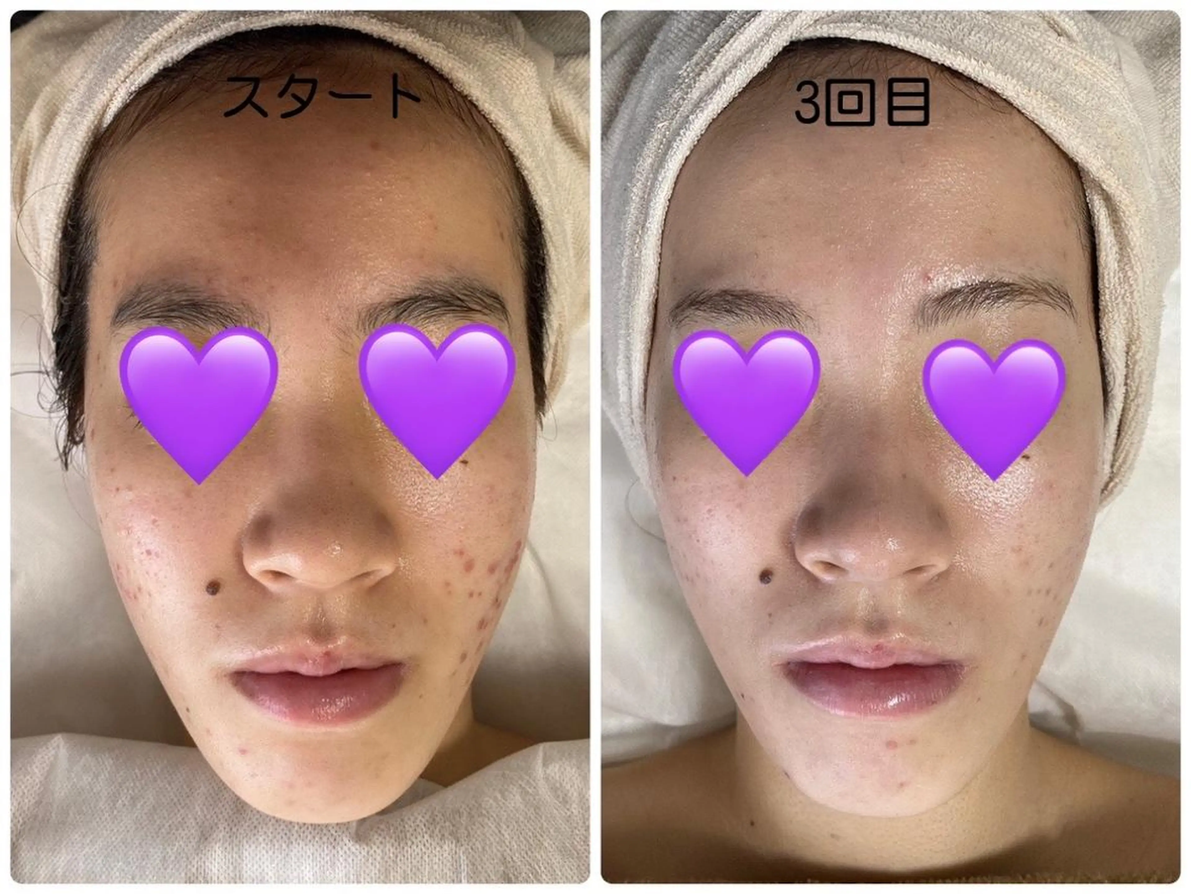 エステ COCO beautyサロンのエステ・リラクイメージ