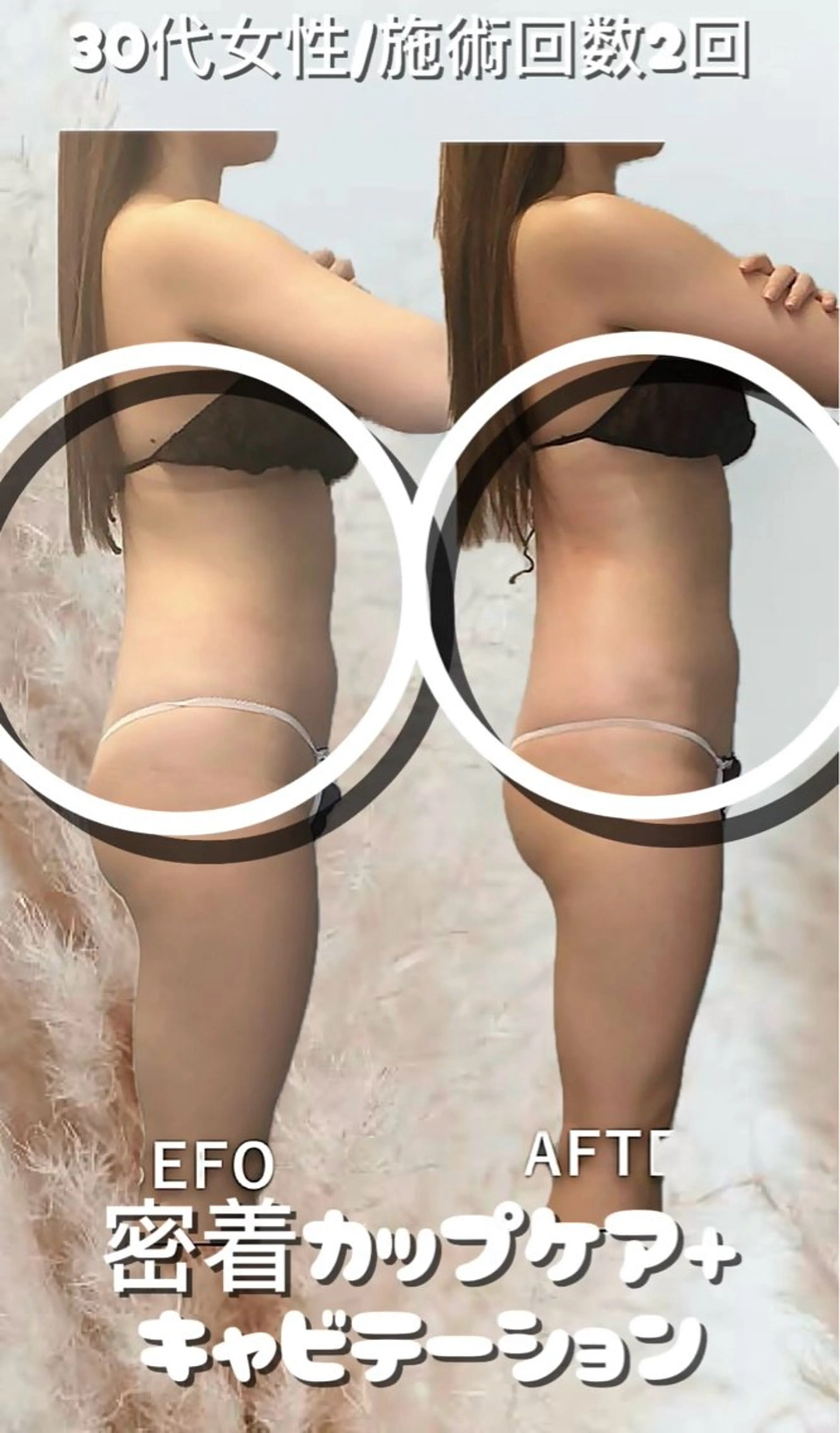 エステ 美容整体・塗る漢方・フェイシャルRechica所属・痩身・脱毛・肌管理 Rechica心斎橋のエステ・リラクイメージ