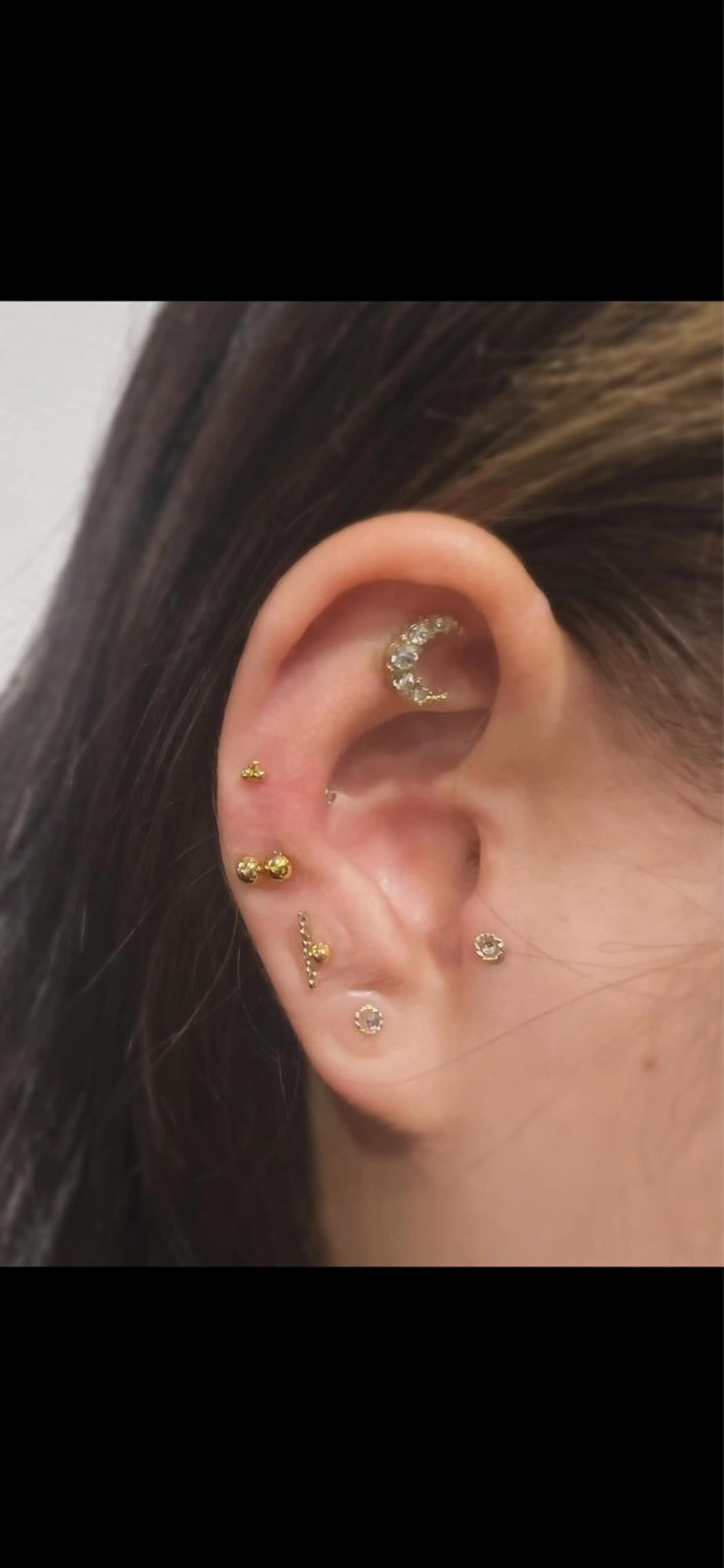 その他 肌質改善|美眉サロンCannone'所属・肌質改善|美眉サロン Cannone’のエステ・リラクイメージ