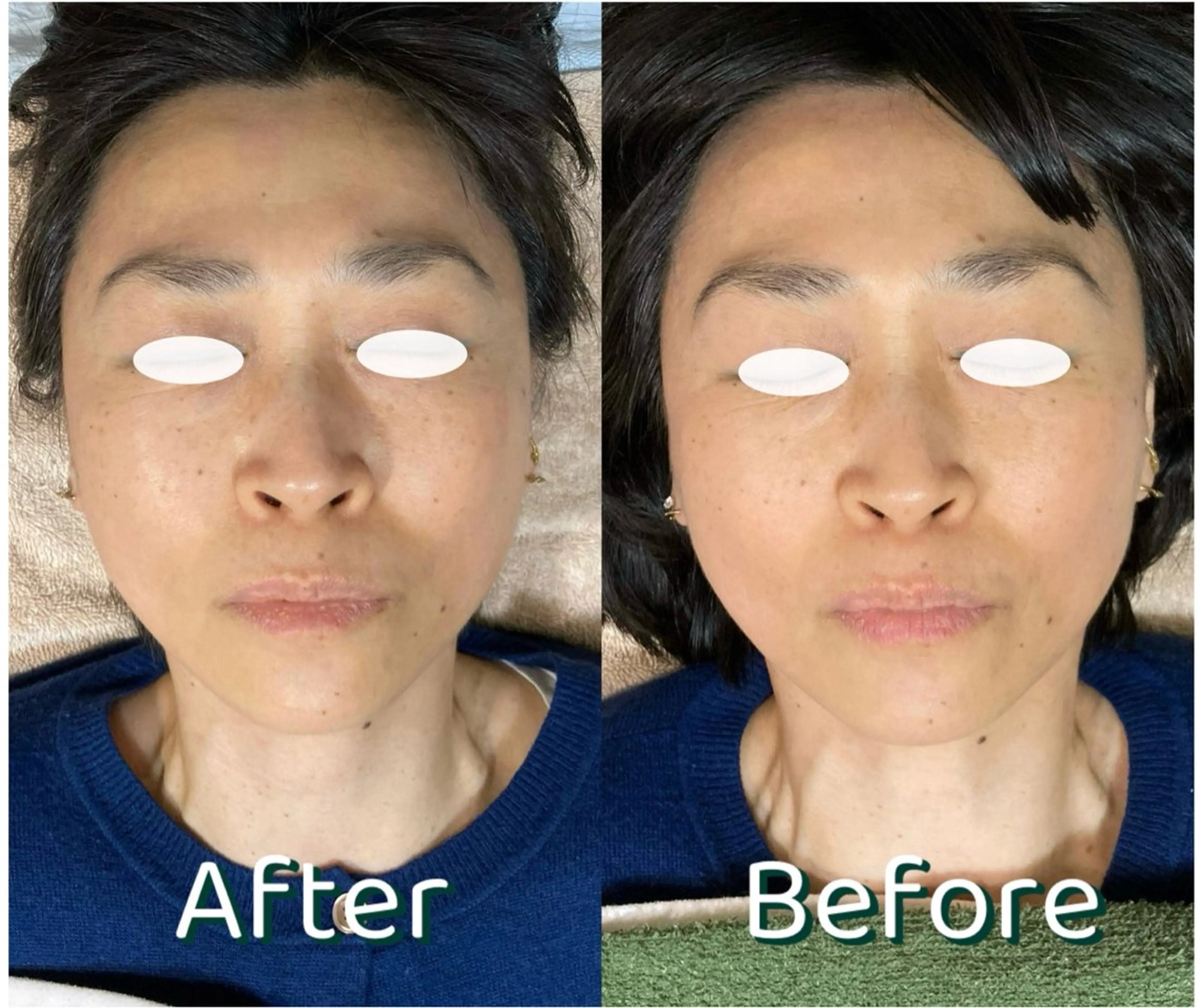 リラク TKサロン所属・TKサロン 柿沼のエステ・リラクイメージ