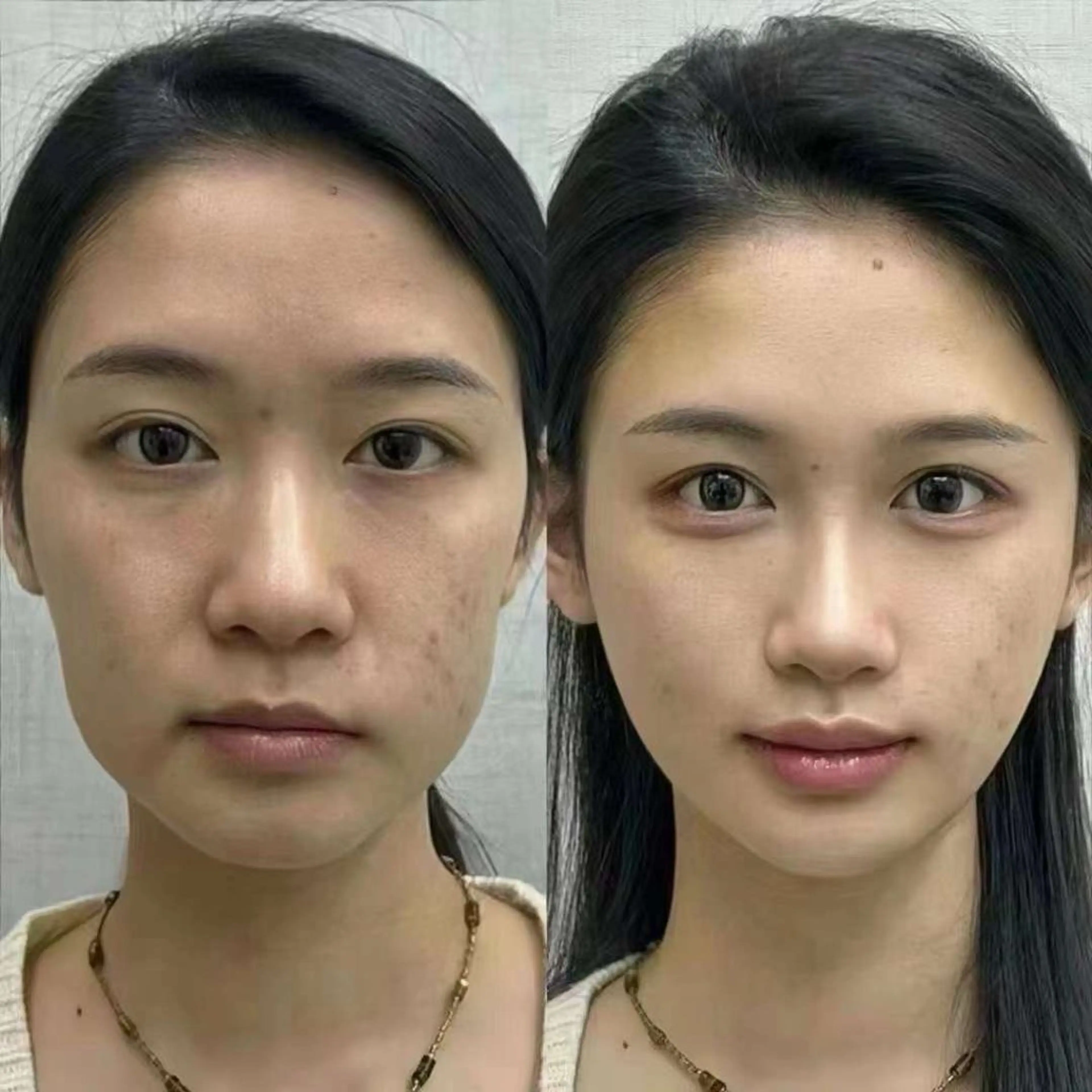 マツエク・マツパ エステ aliaハーブ水光店 エステティシャン募集のエステ・リラクイメージ