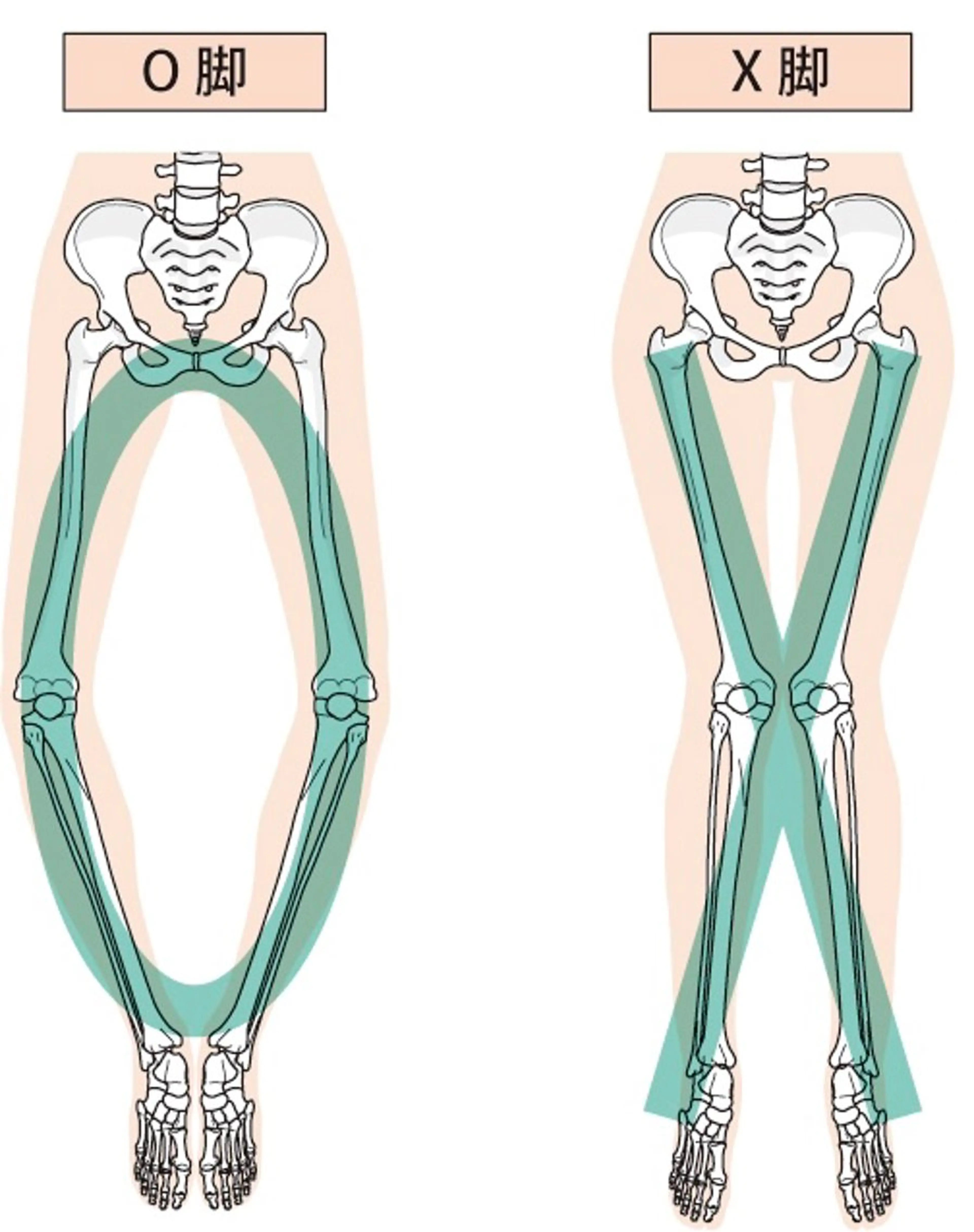 【むくみ、ダイエット】女性に大好評の『むくみ』『ダイエット』ケアコース✨なぜむくみや脂肪がつくのか？分かりやすく解説❗️の写真