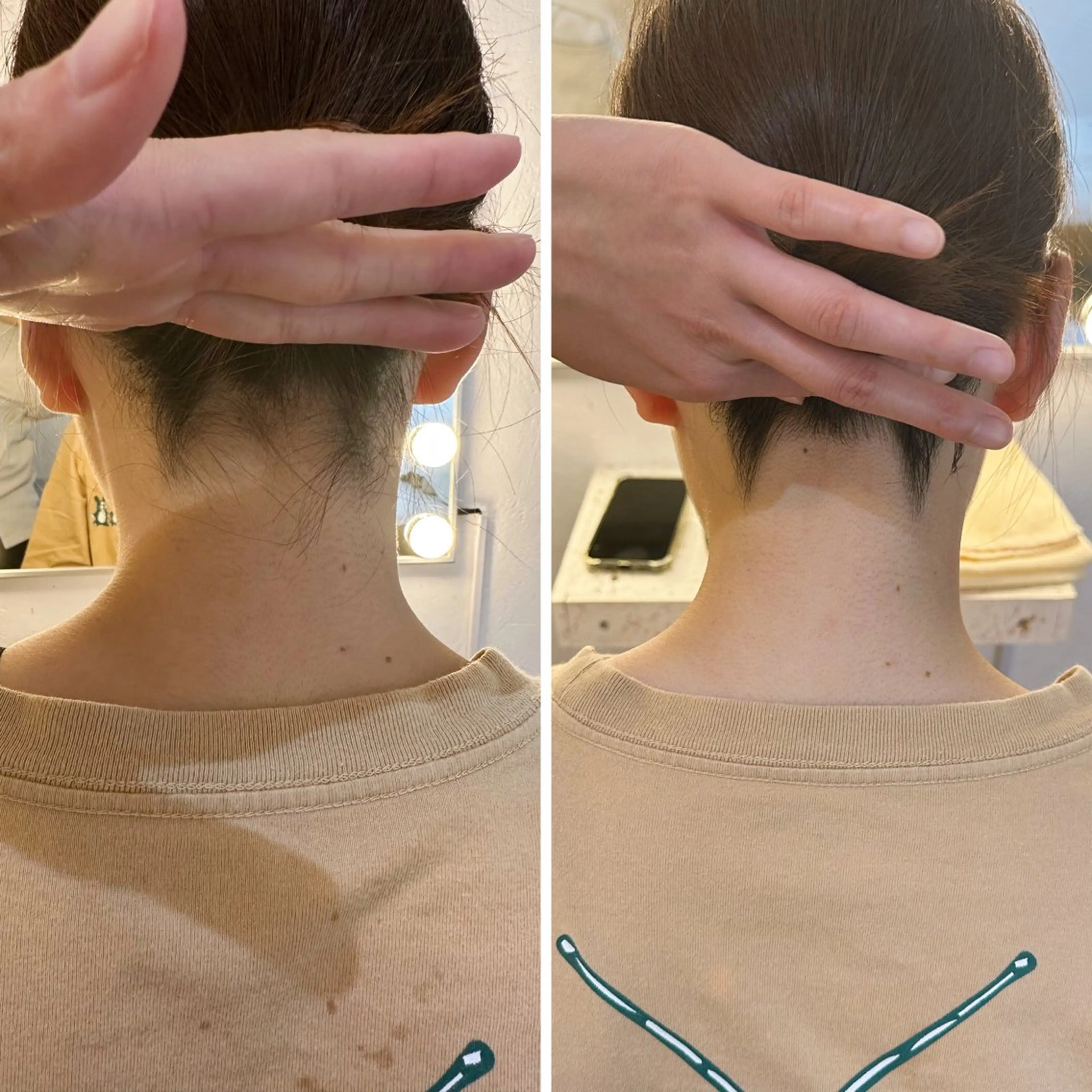 脱毛 うなじ脱毛/美肌脱毛 LABELのエステ・リラクイメージ