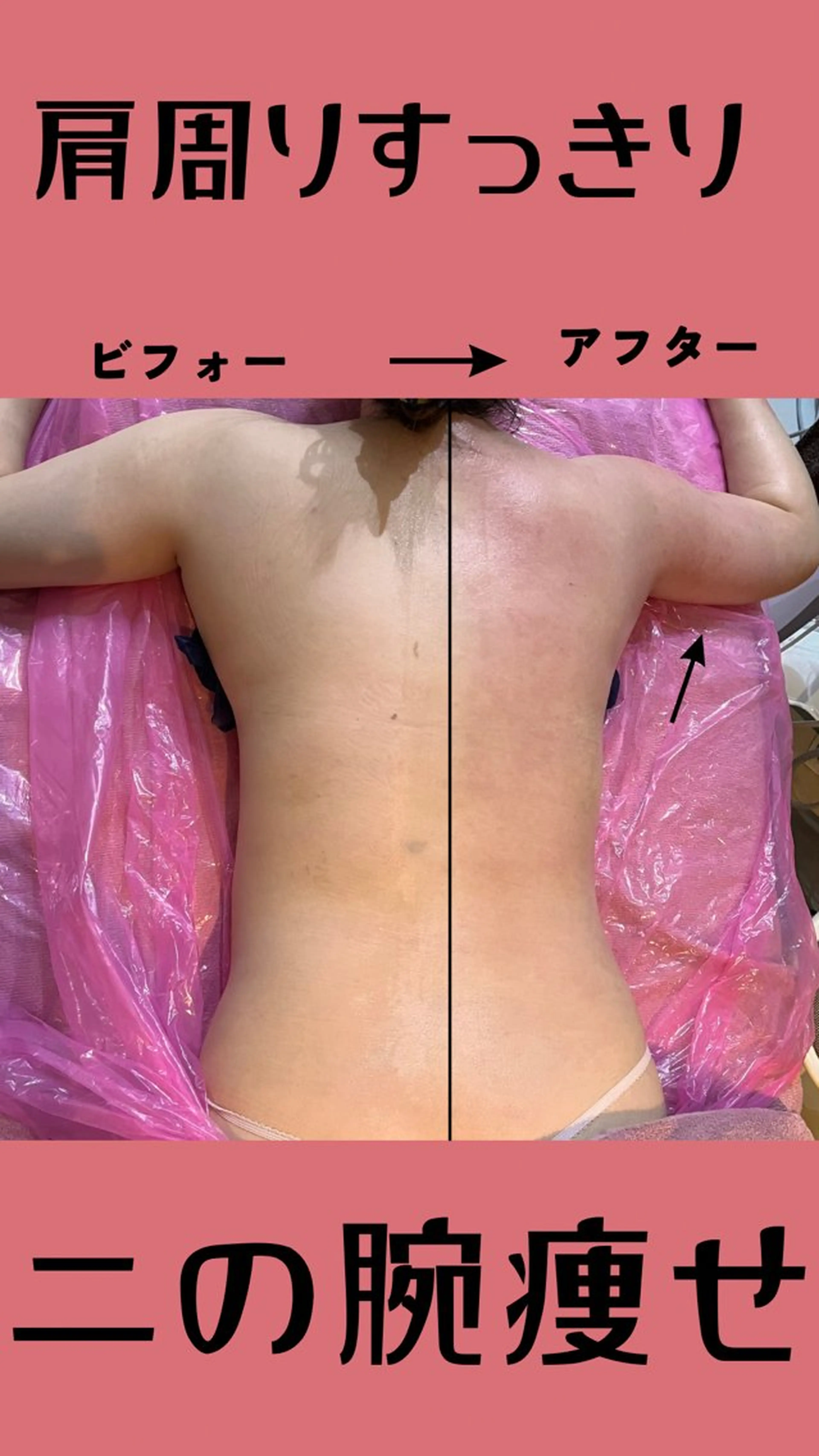 その他 温活beautyサロンNeroli所属・切らない脂肪吸引🔥 Neroliまりこのエステ・リラクイメージ