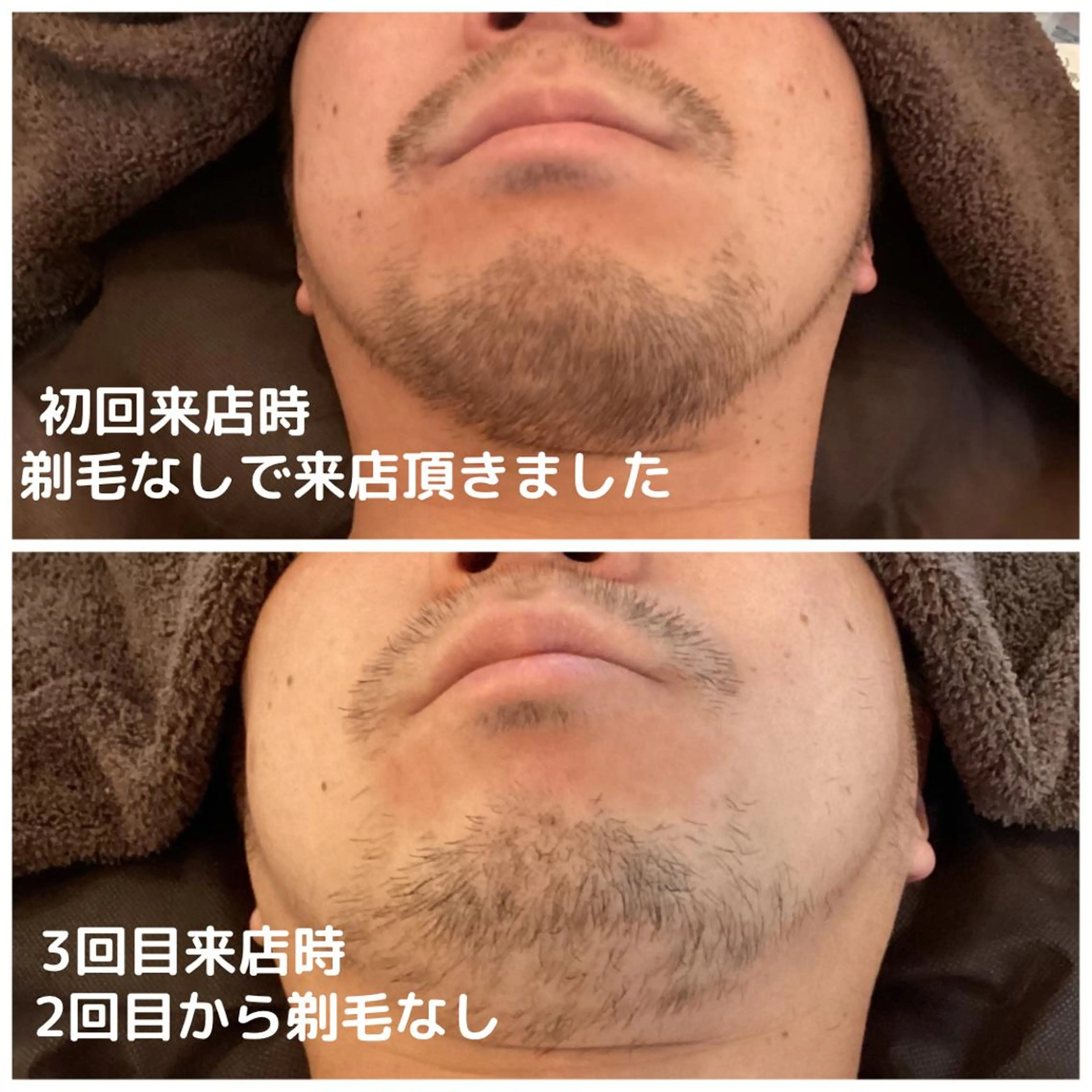 メンズ men's脱毛サロン ECXIAのエステ・リラクイメージ