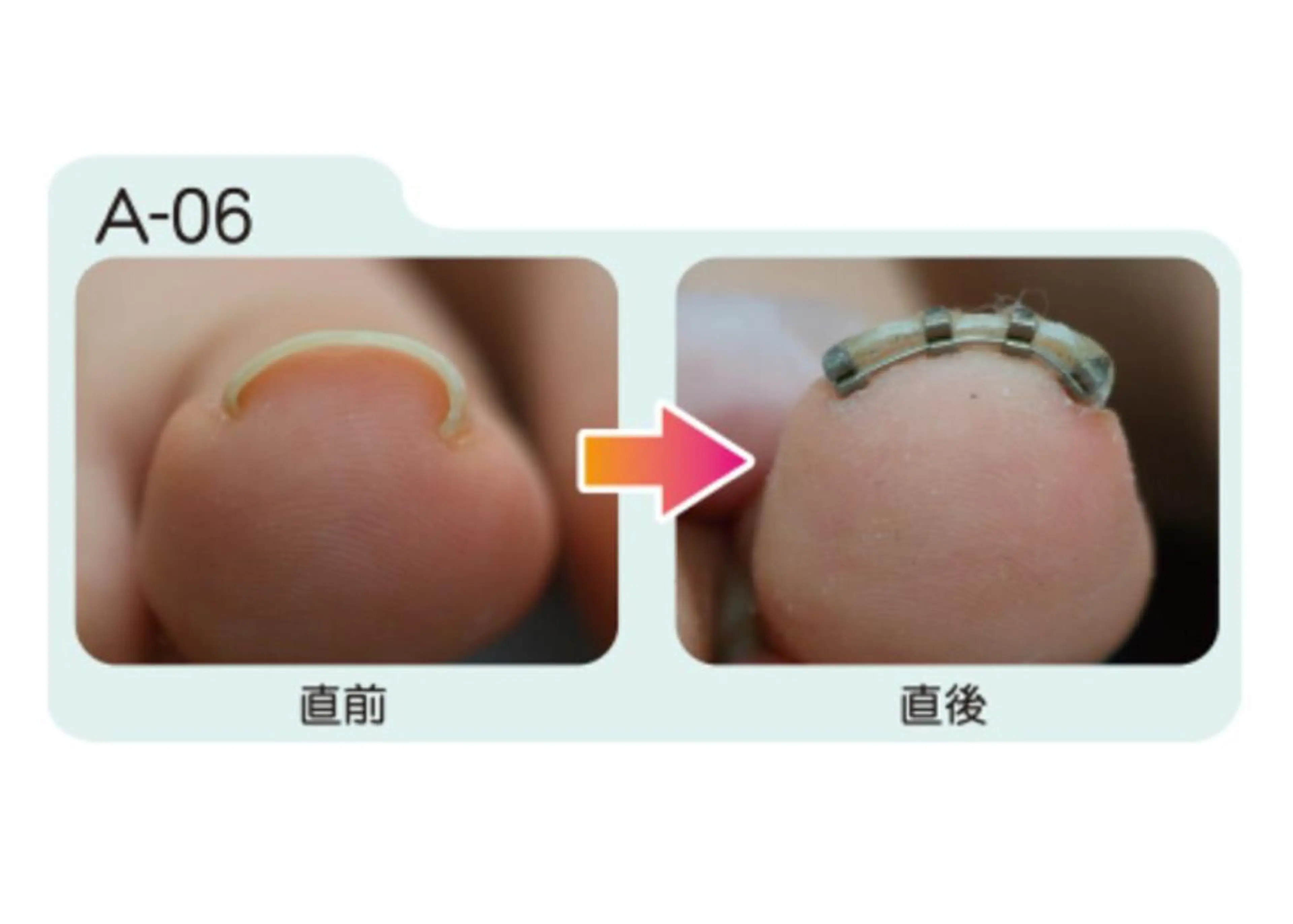 メンズ キッズ ネイル フットネイル 🌱 ま し お 🌱のその他イメージ