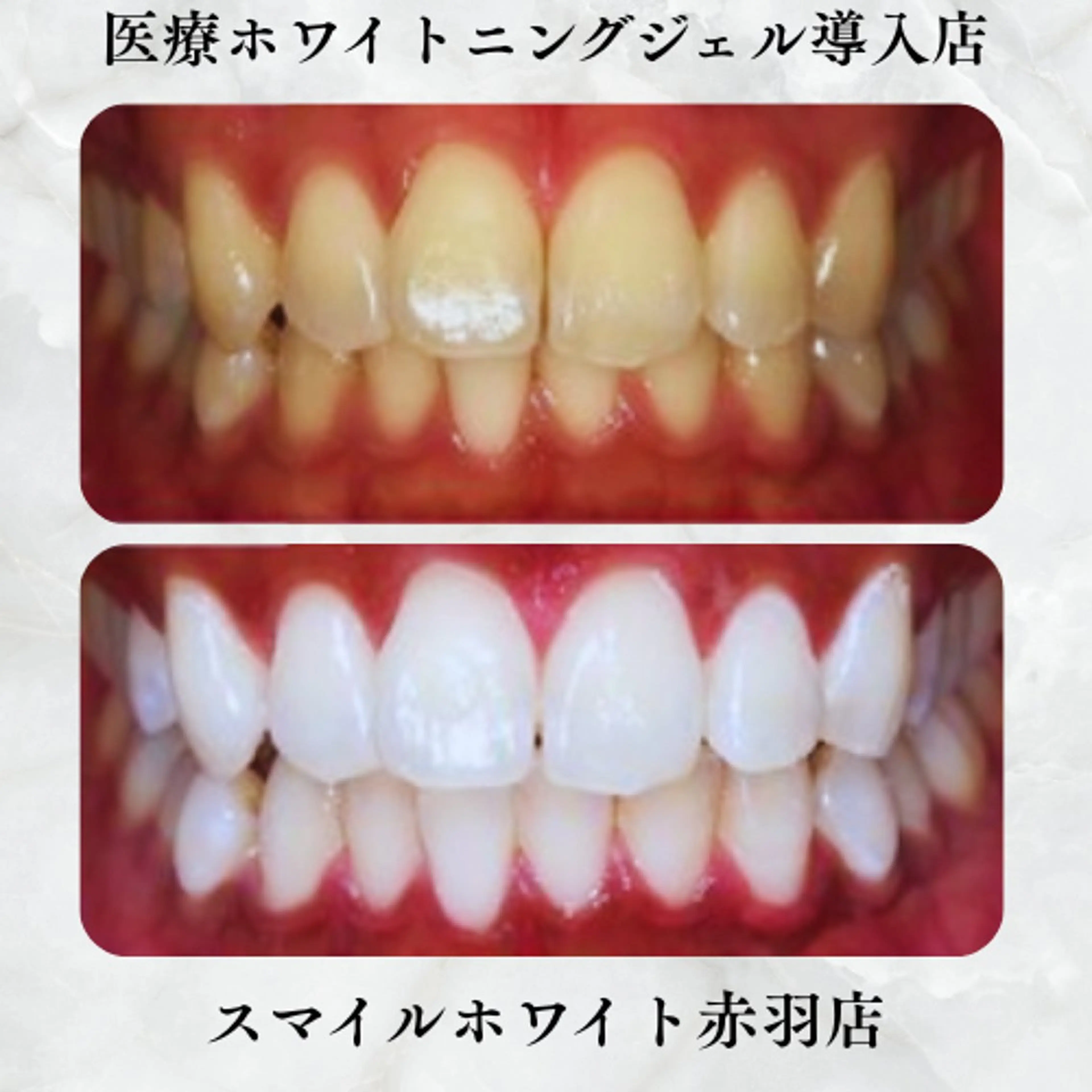 ショート スマイルホワイト 赤羽店のエステ・リラクイメージ