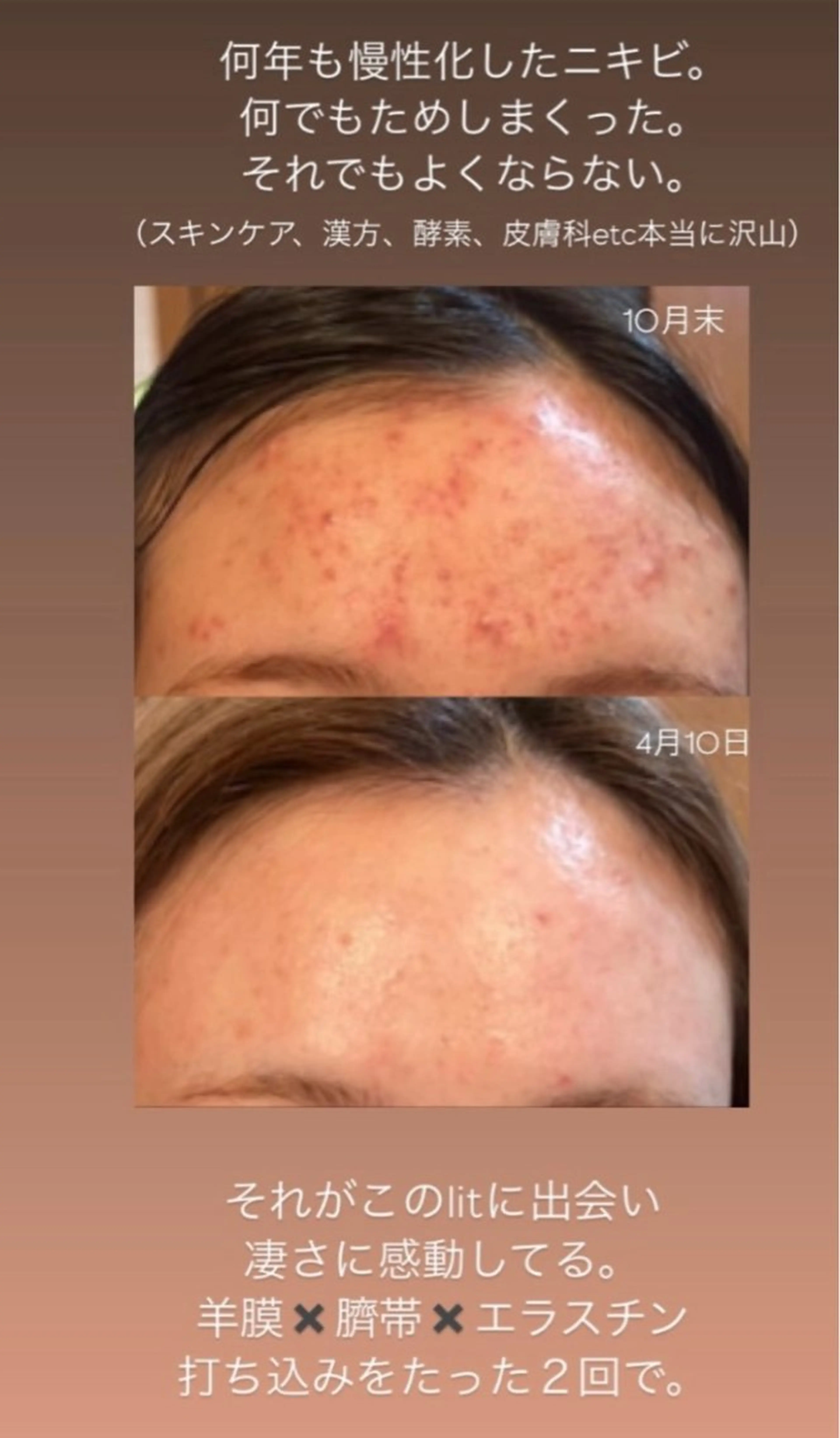 Terra.所属・松村 彩乃のエステ・リラクイメージ