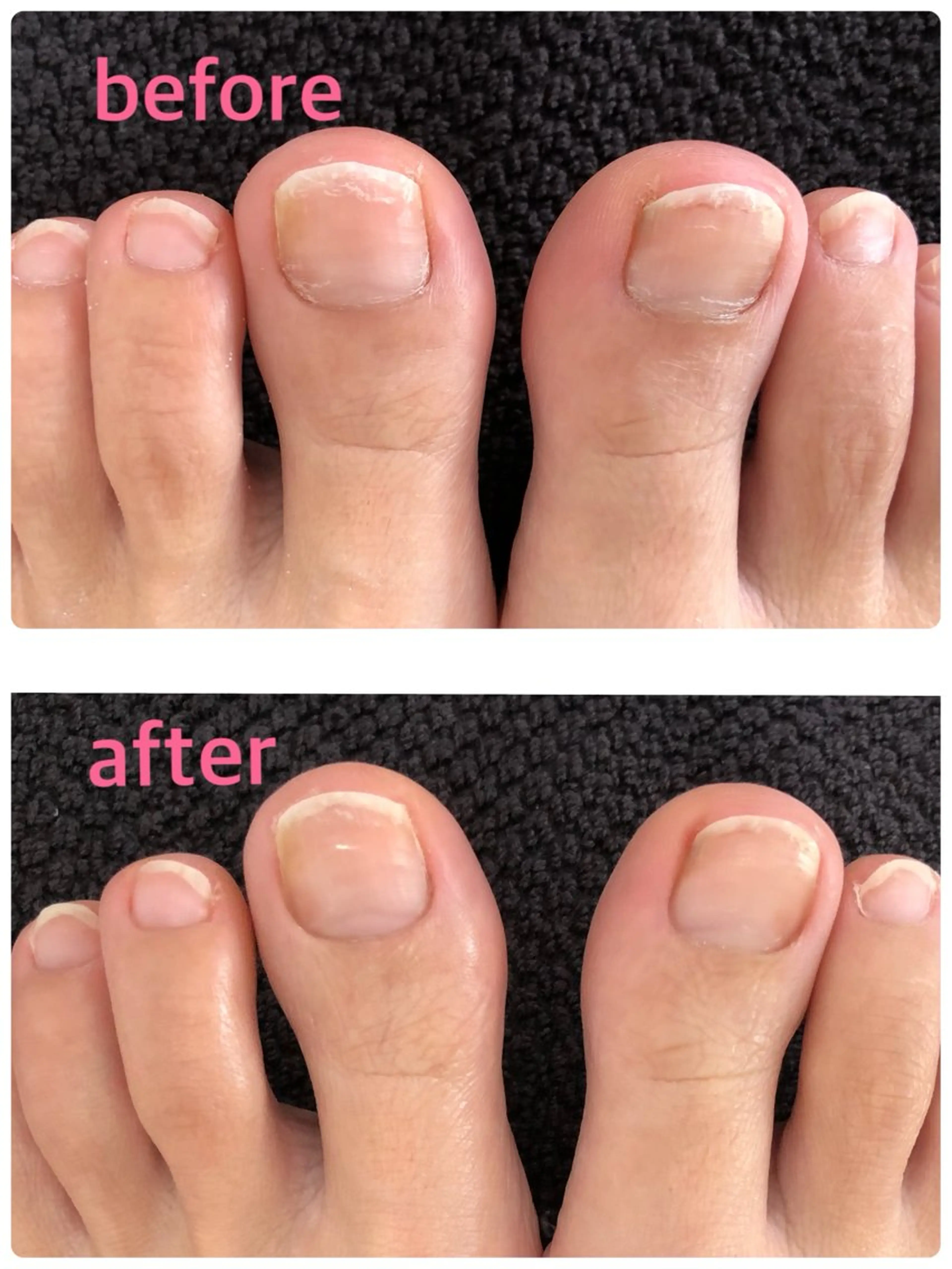 ⭐️1日1名限定⭐️フットバス付き！フットケアの写真