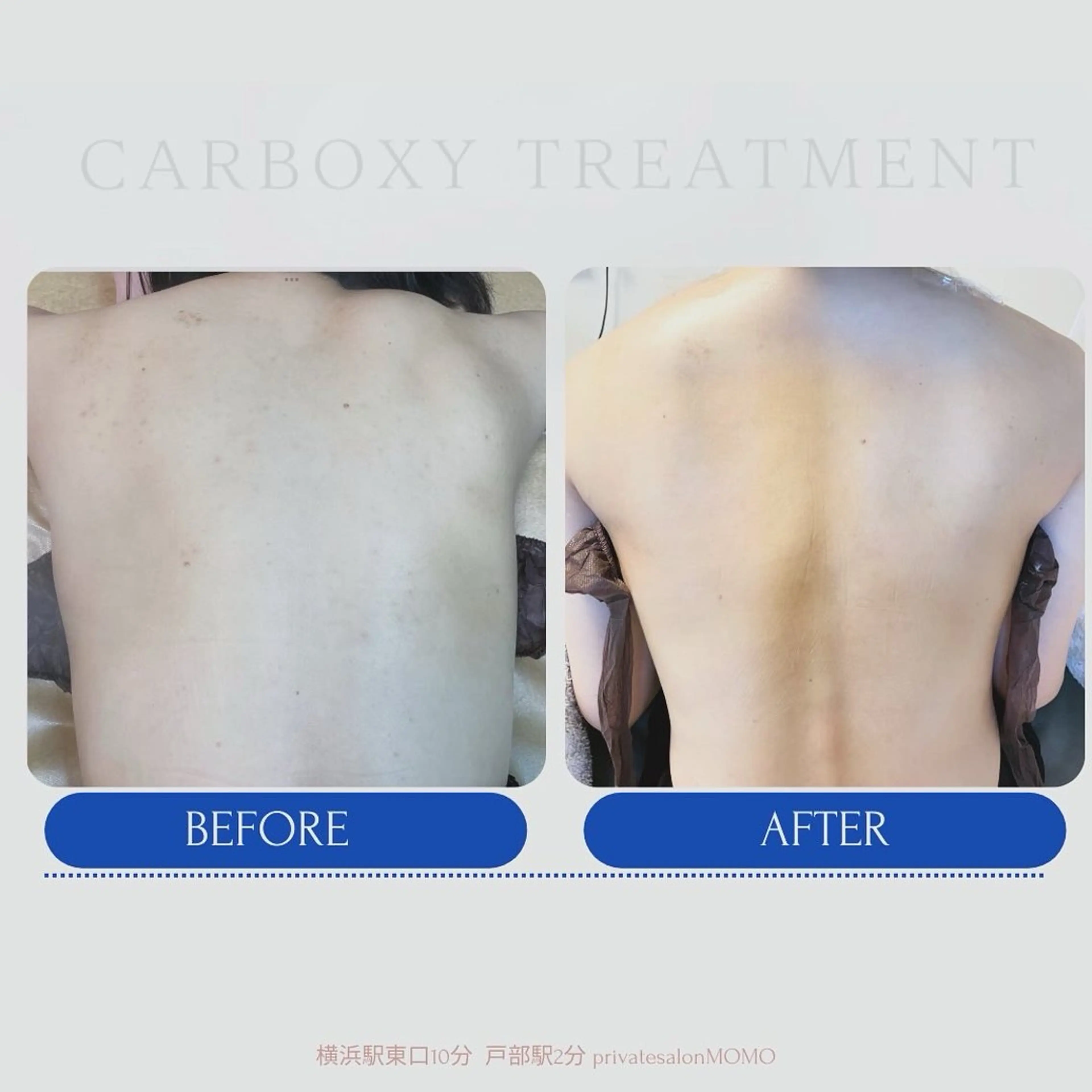 代表 MOMOのエステ・リラクイメージ