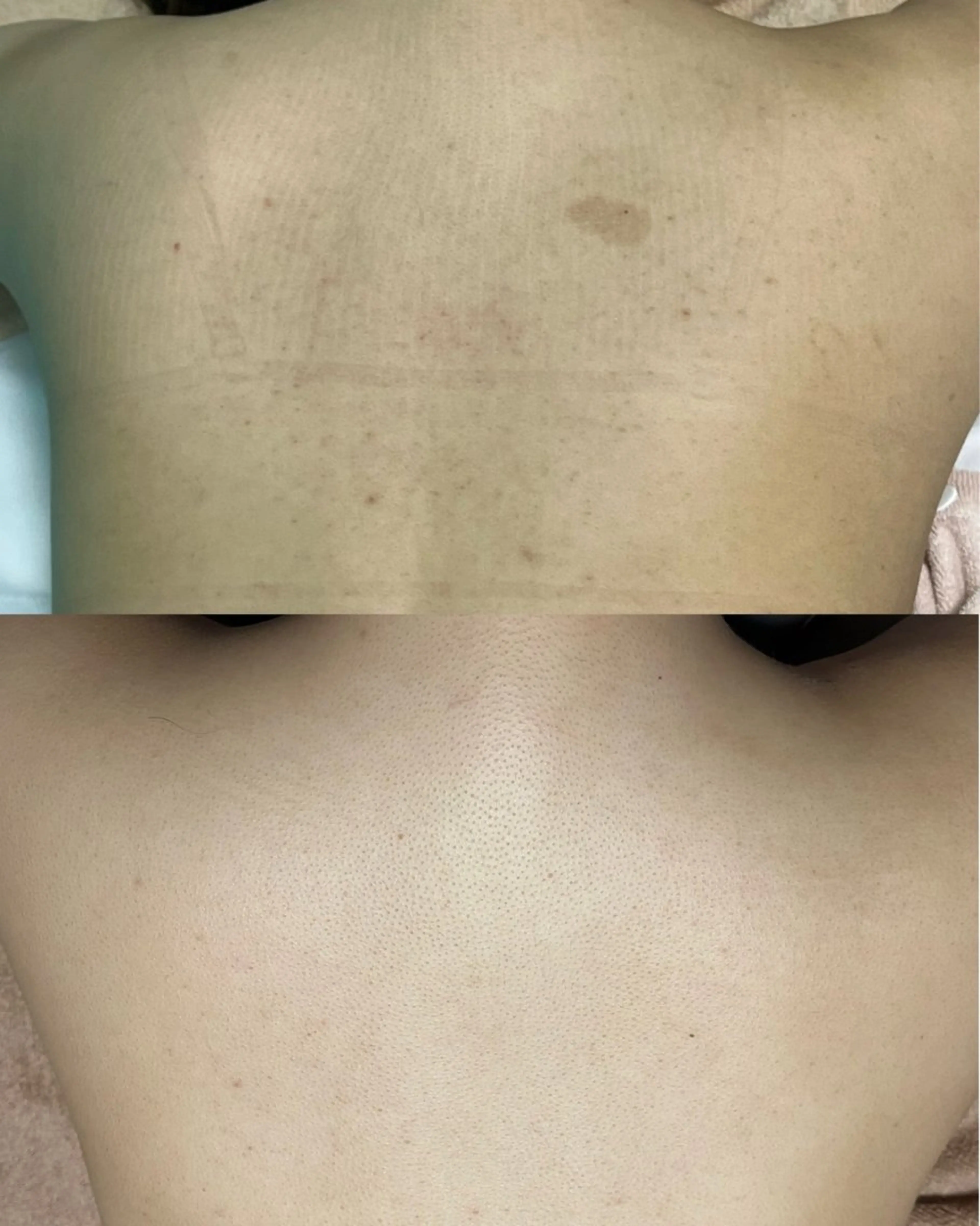 y2k SALONのエステ・リラクイメージ