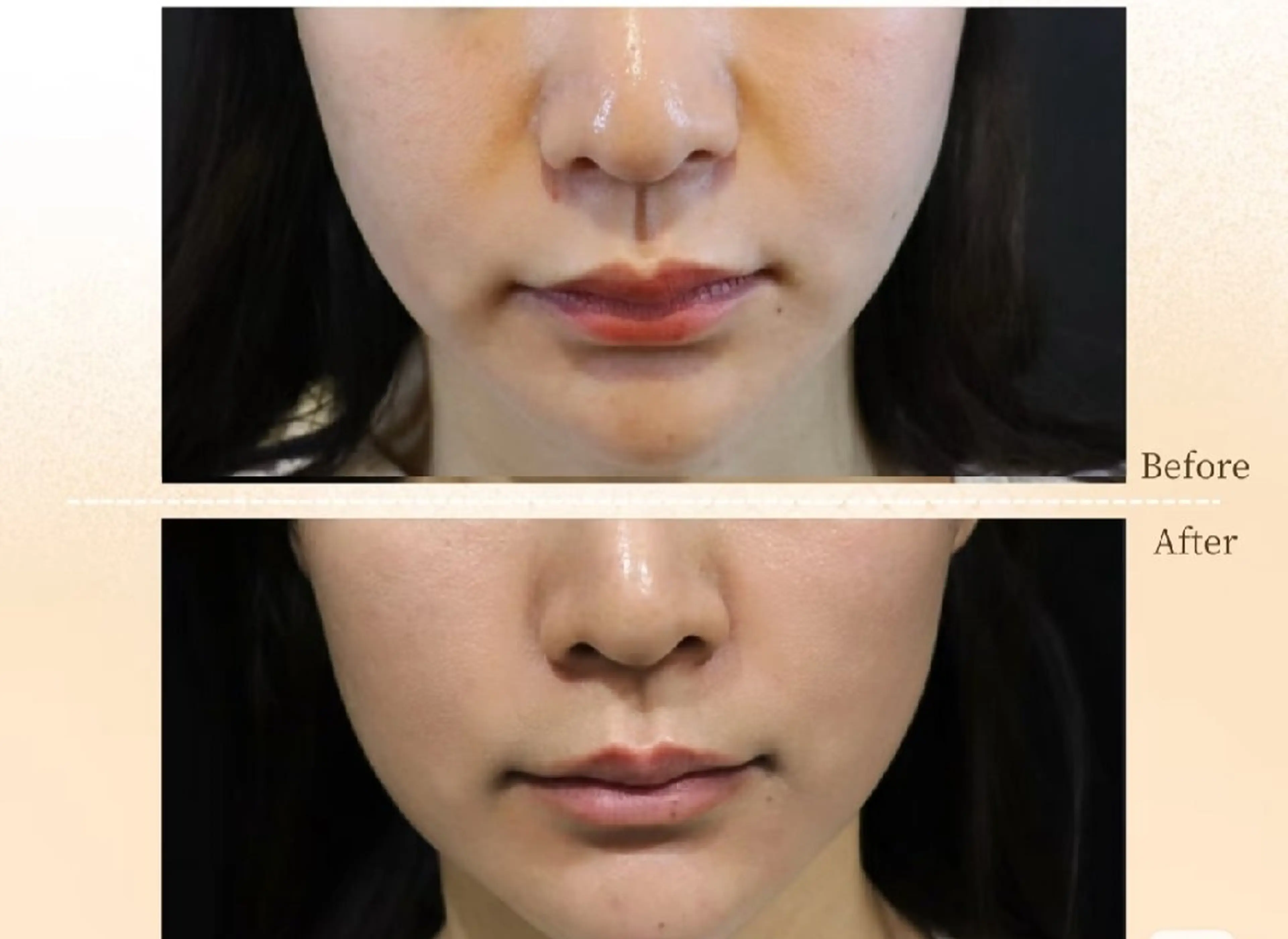 アイブロウ 眉毛ワックス脱毛 aliaハーブ水光店 エステティシャン募集のエステ・リラクイメージ