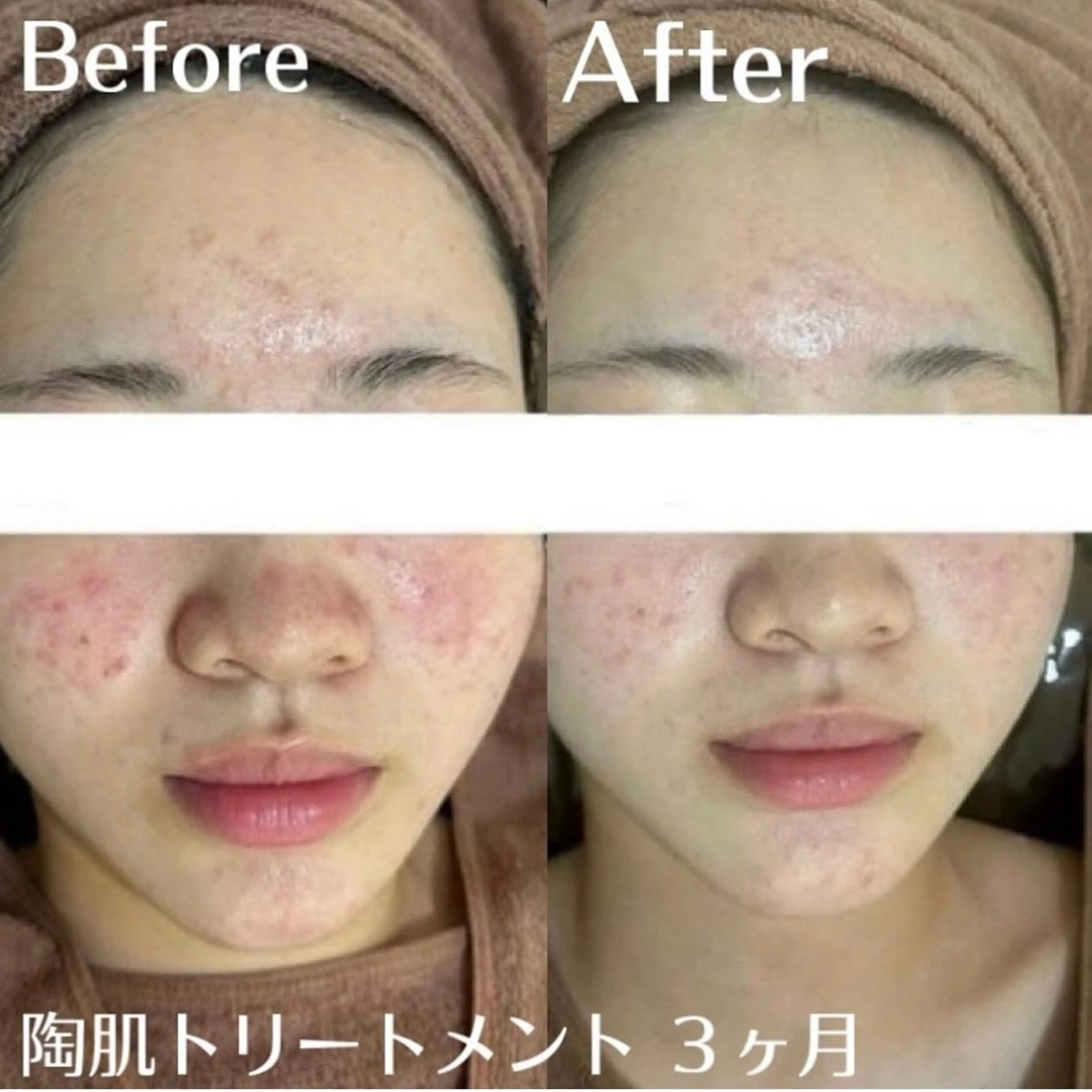 中目黒ハーブピーリン グ🌿ララピールのエステ・リラクイメージ