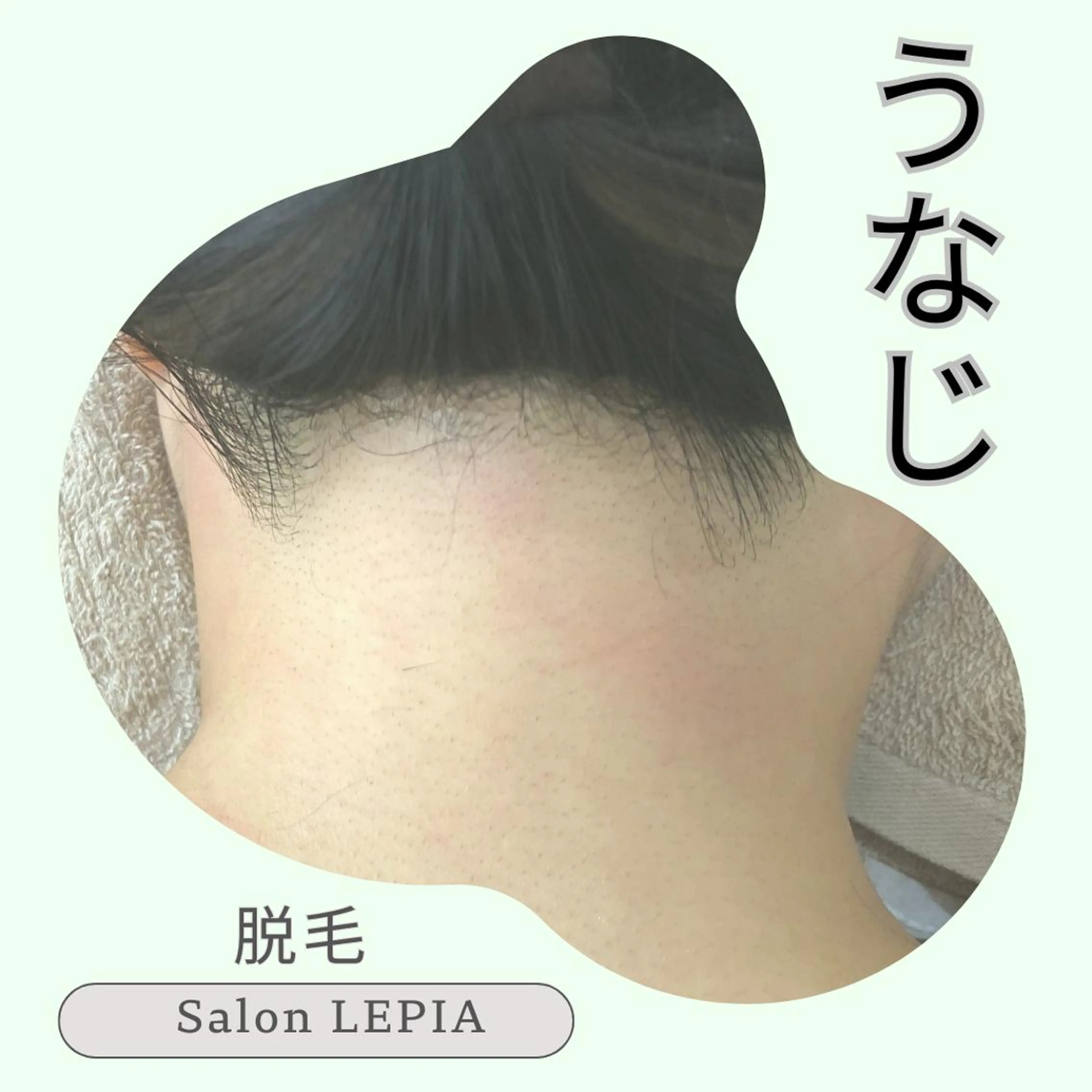 4月キャンペーン🩵うなじ「デザインシェービング込み」脱毛 ¥4400円→¥3300円の写真