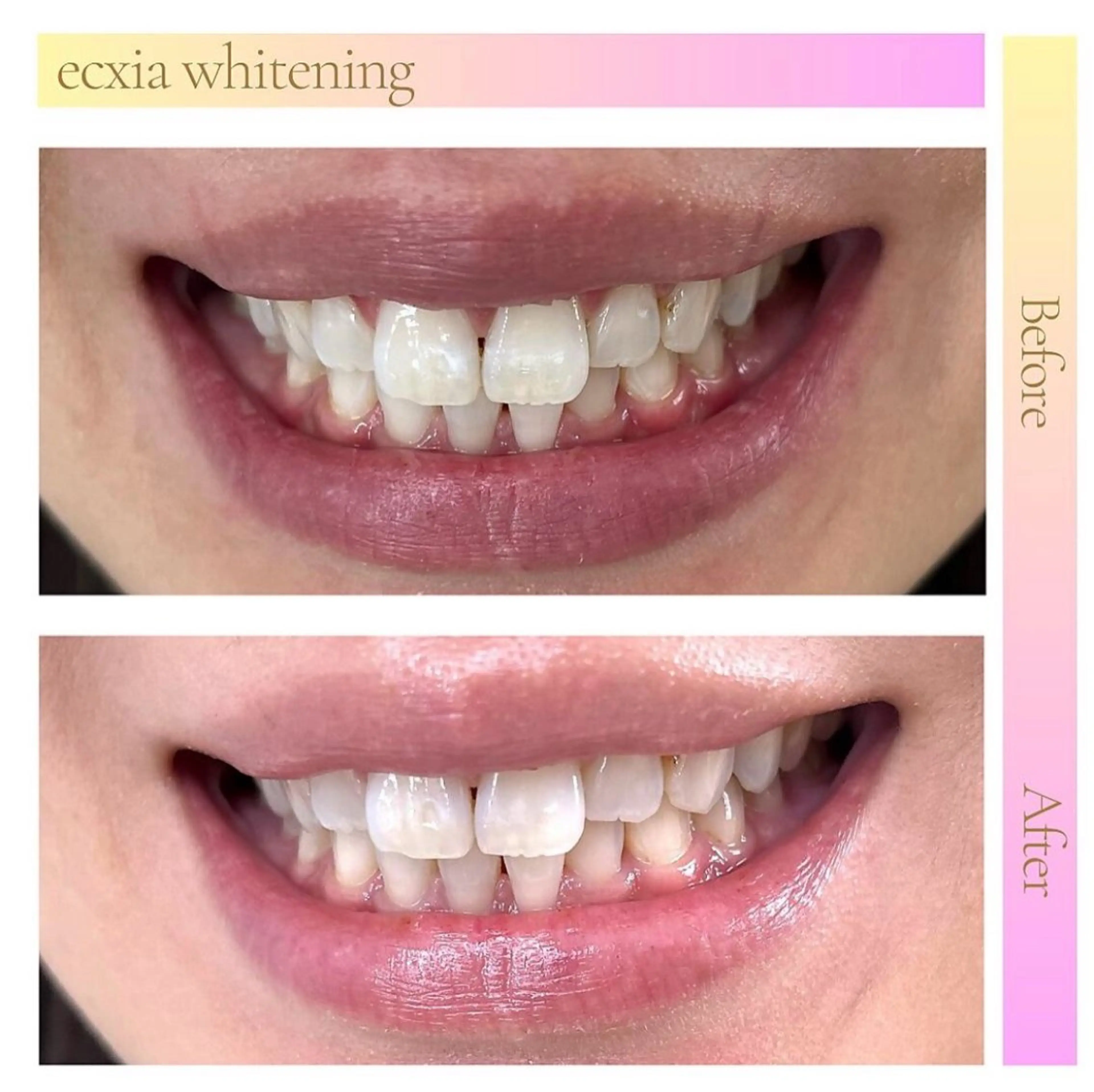 セルフホワイトニング エクシア武蔵小杉店のその他イメージ