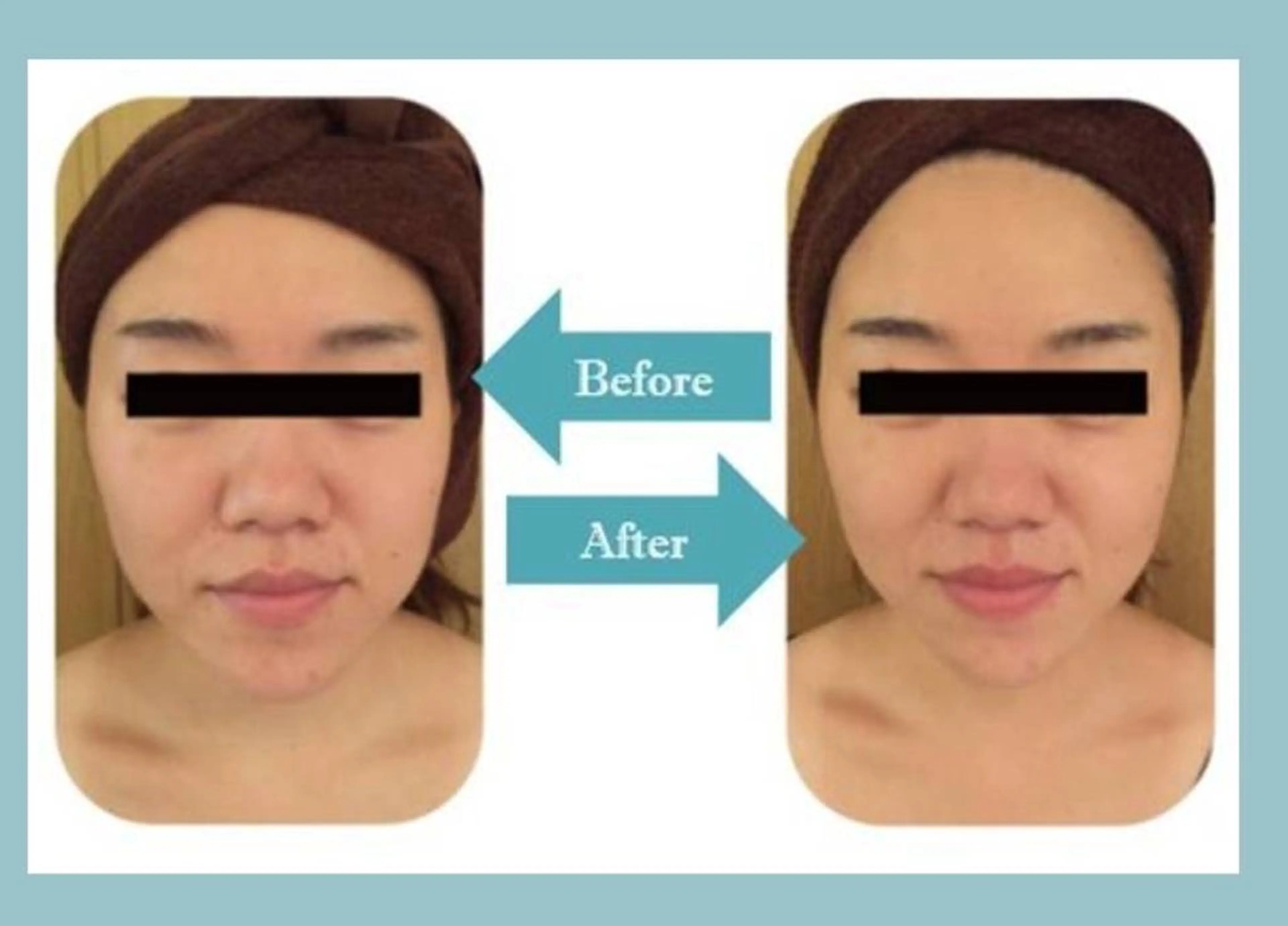 痩身・小顔・美肌専門 Chou chouのエステ・リラクイメージ