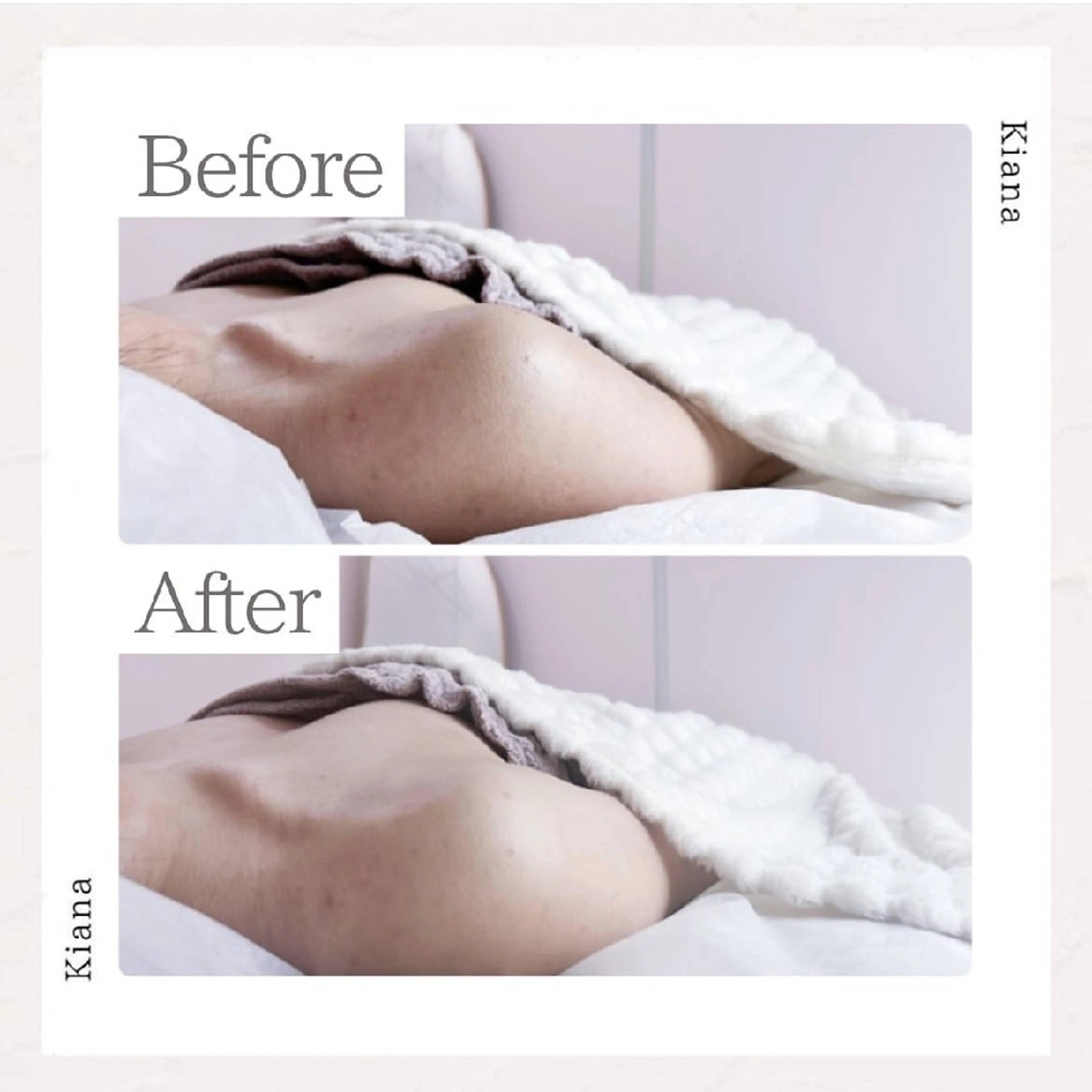 エステ リラク 【バスト専門店 】 Kiana のエステ・リラクイメージ