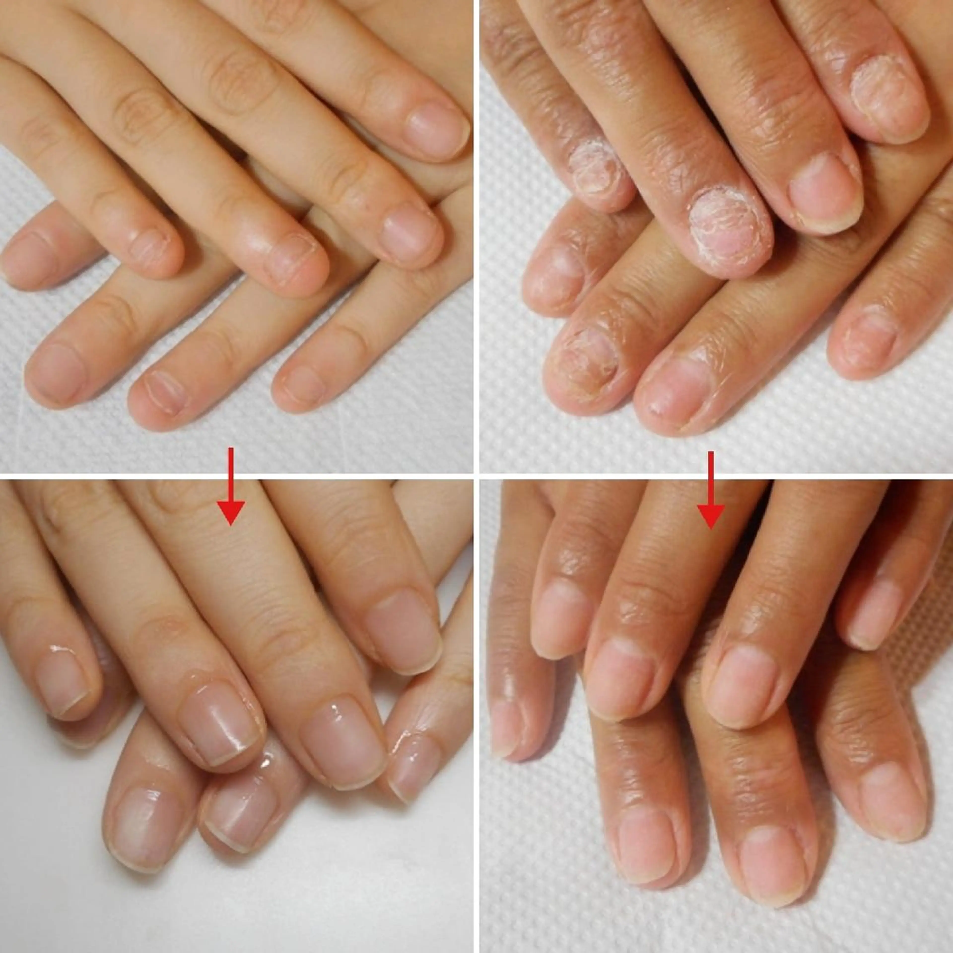 ネイル ネイルサロン アリュームのネイルデザイン