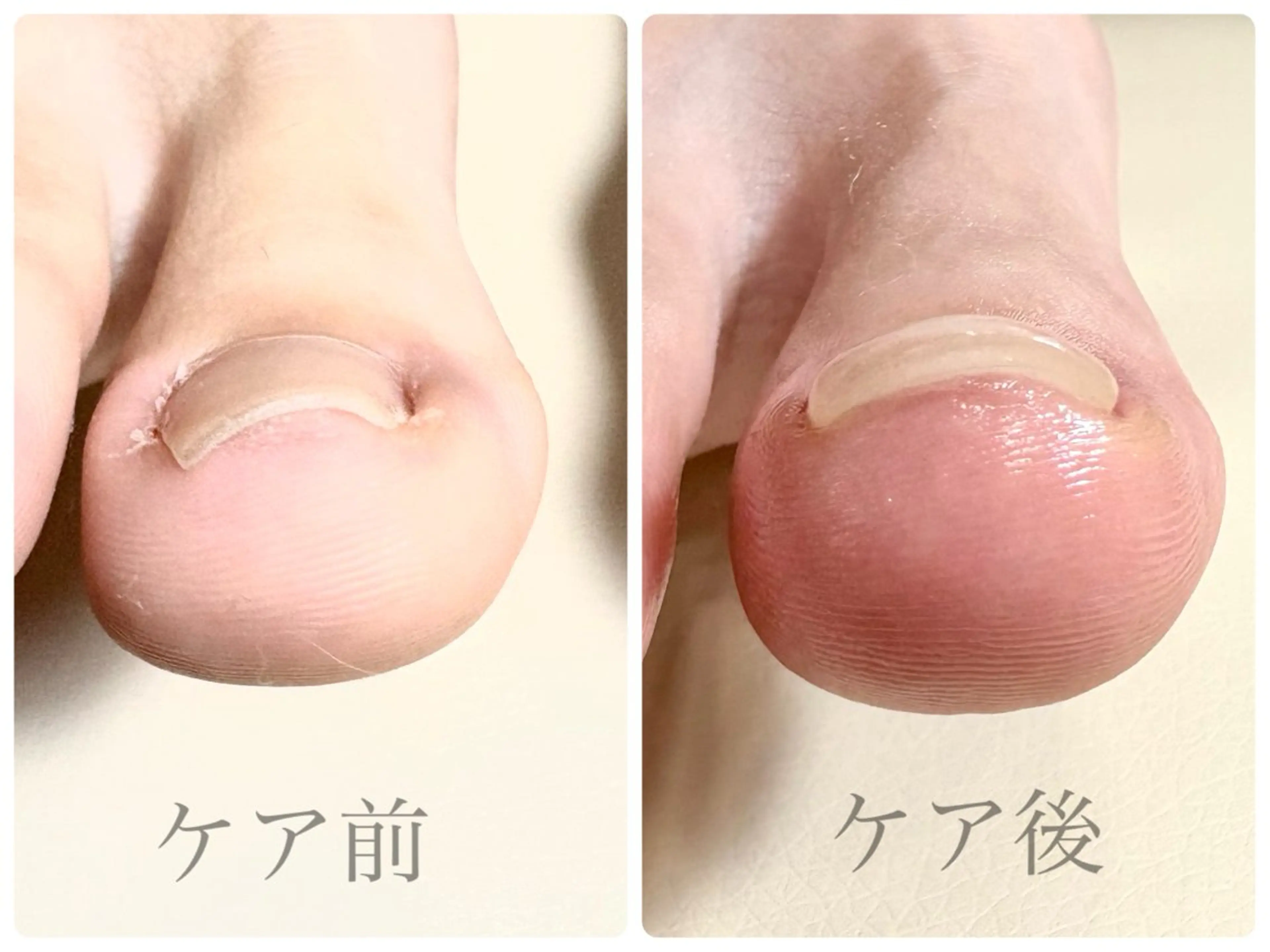 荒井 恵のネイルデザイン