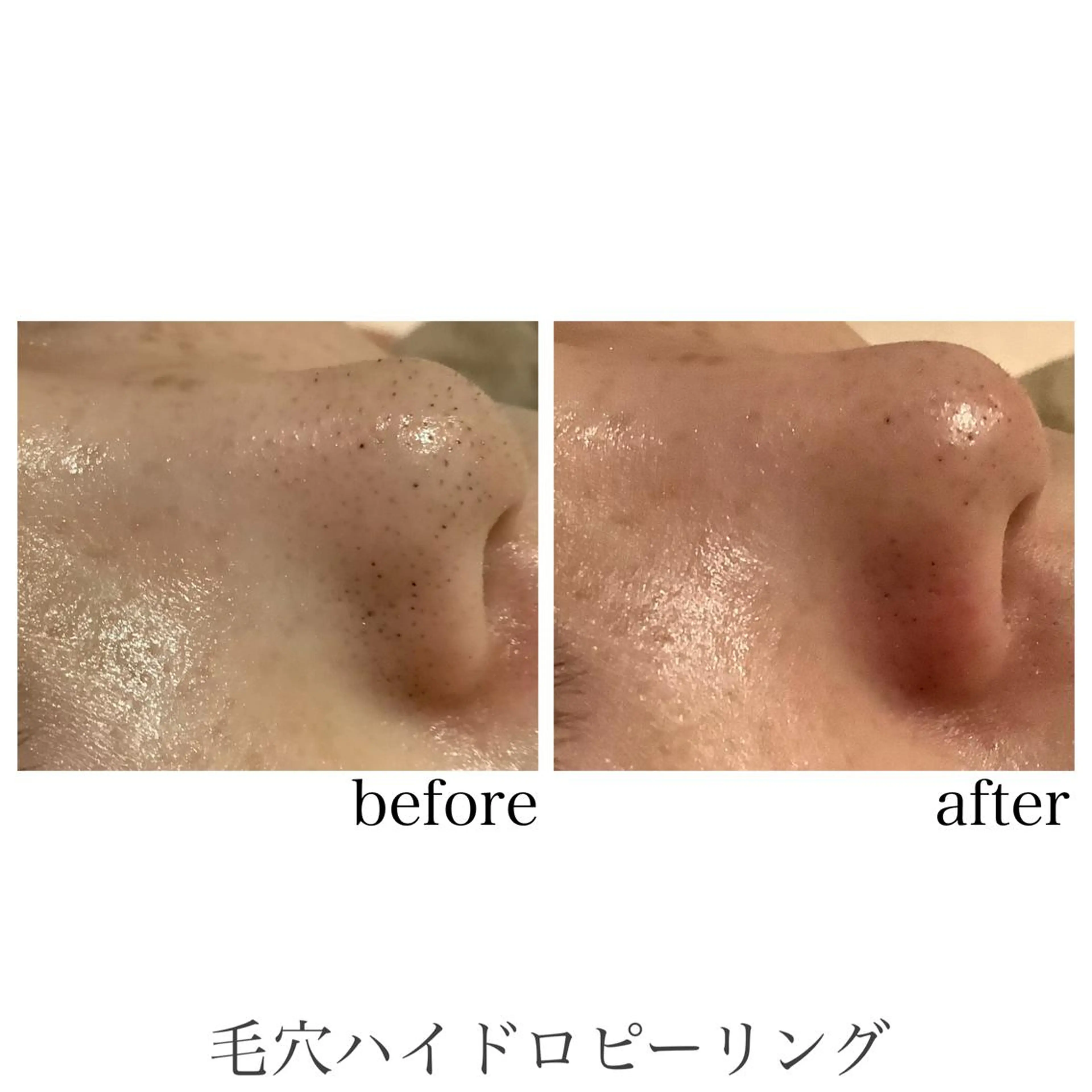 エステ 脱毛&エステサロン JIGGLY武蔵小山のエステ・リラクイメージ