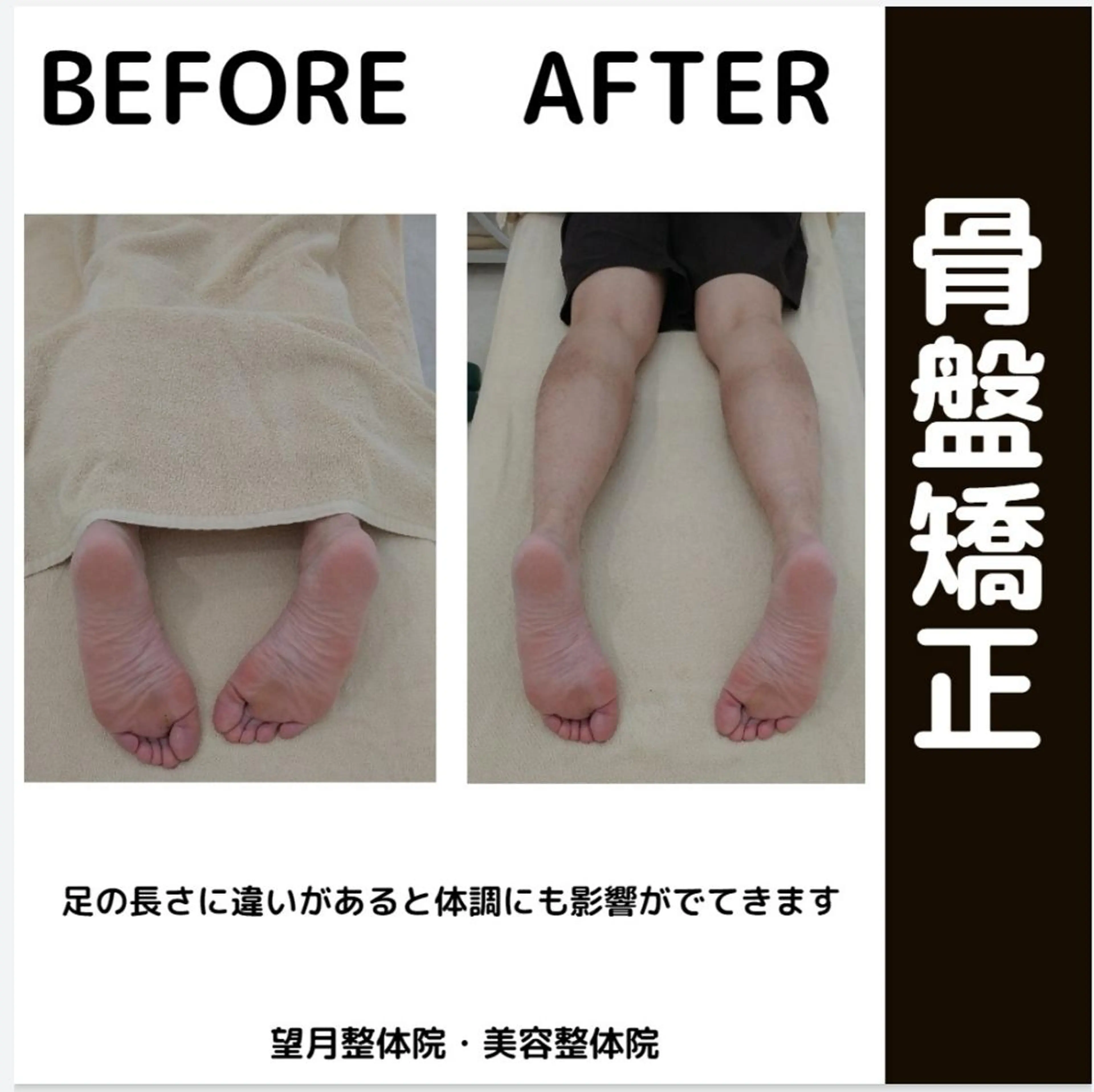 【美容整体(猫背➕骨盤)】整体・矯正 60分 ポキポキしない姿勢矯正!1回の施術で変わる!の写真