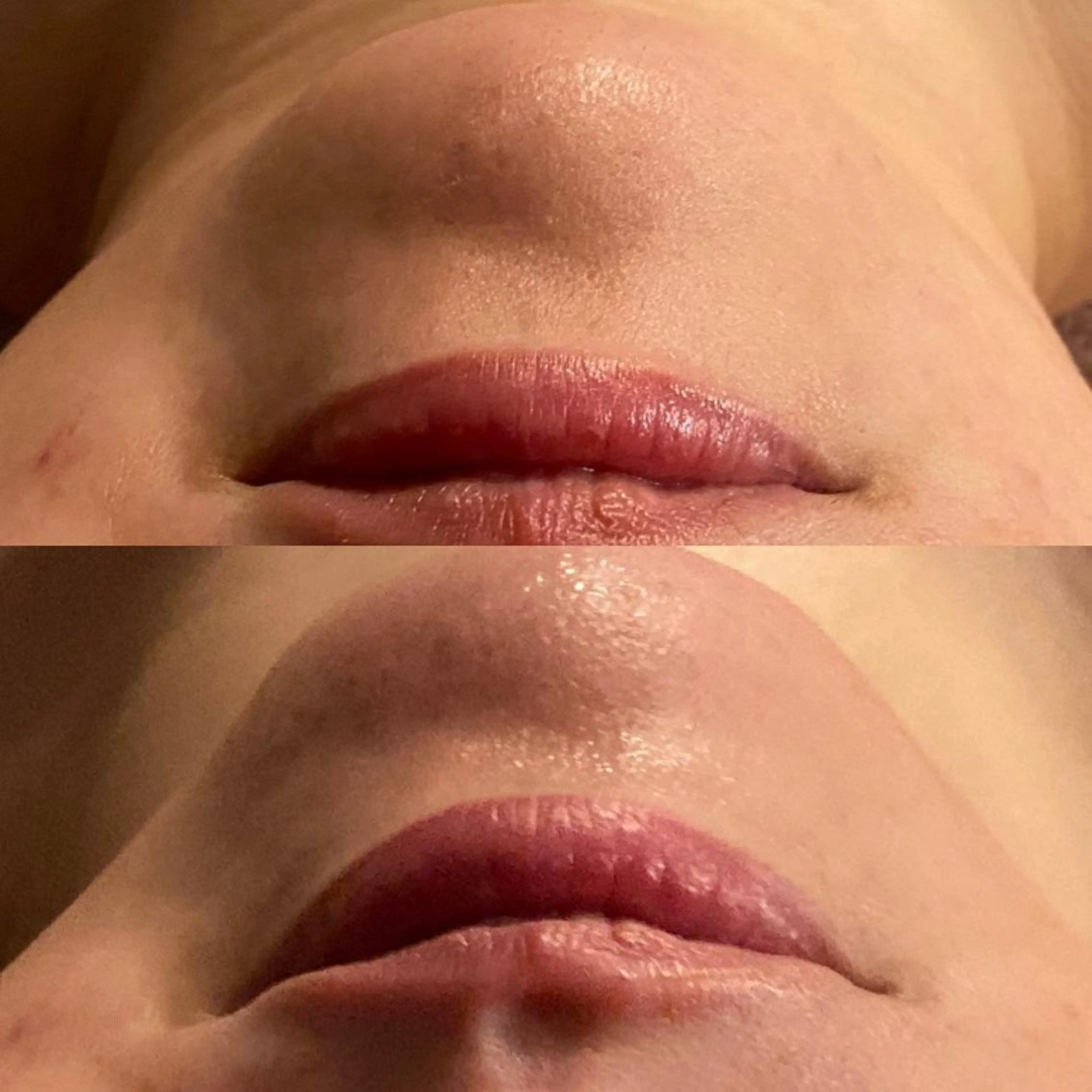 Mandarin Orange所属・毛穴から始める肌メン テマンダリンオレンジのエステ・リラクイメージ