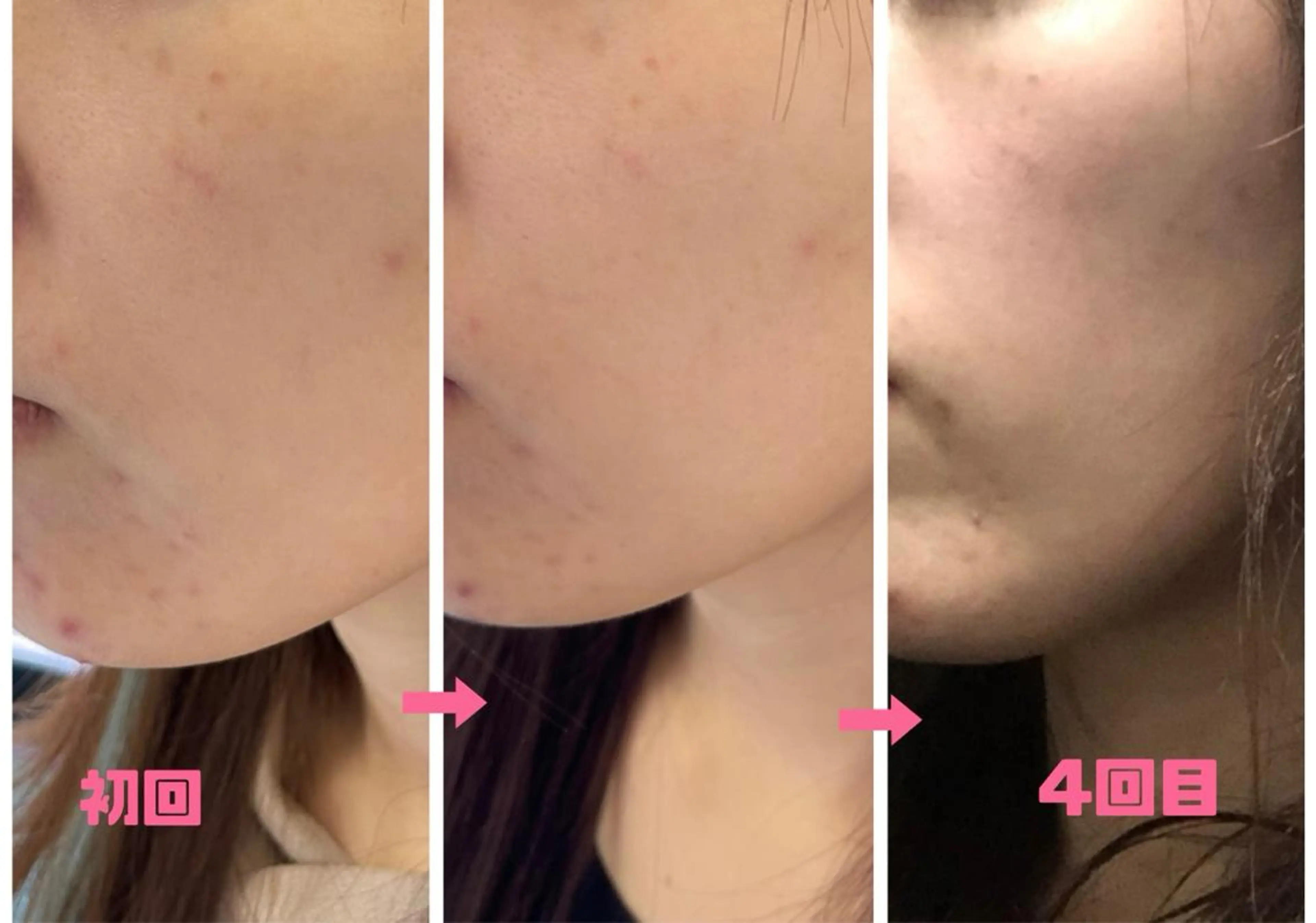 エステ 米田 ひかるのエステ・リラクイメージ