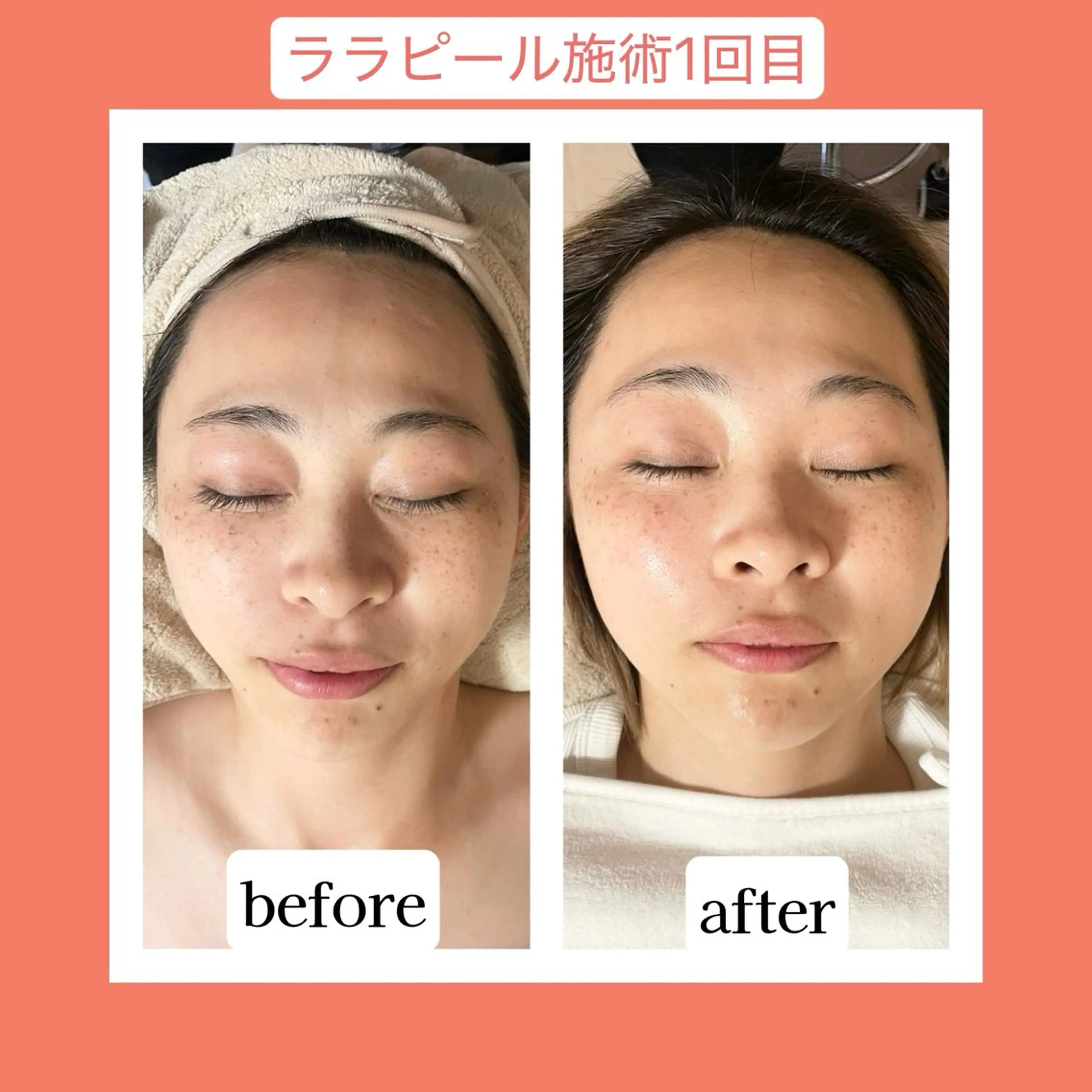 💜Karen PrivateSpaのエステ・リラクイメージ