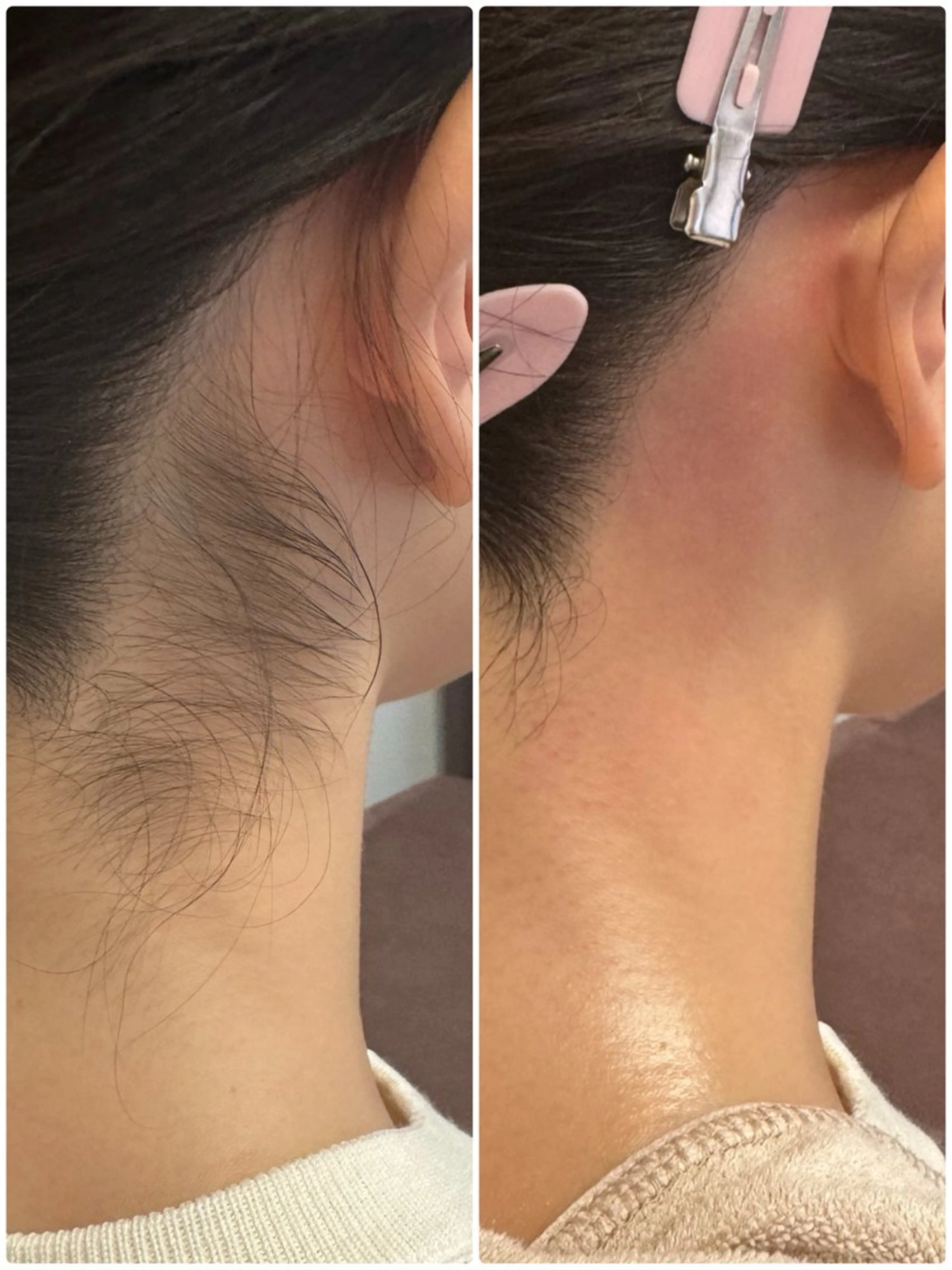 脱毛 恵比寿🌻ワックス 顔うなじVIOワキのエステ・リラクイメージ