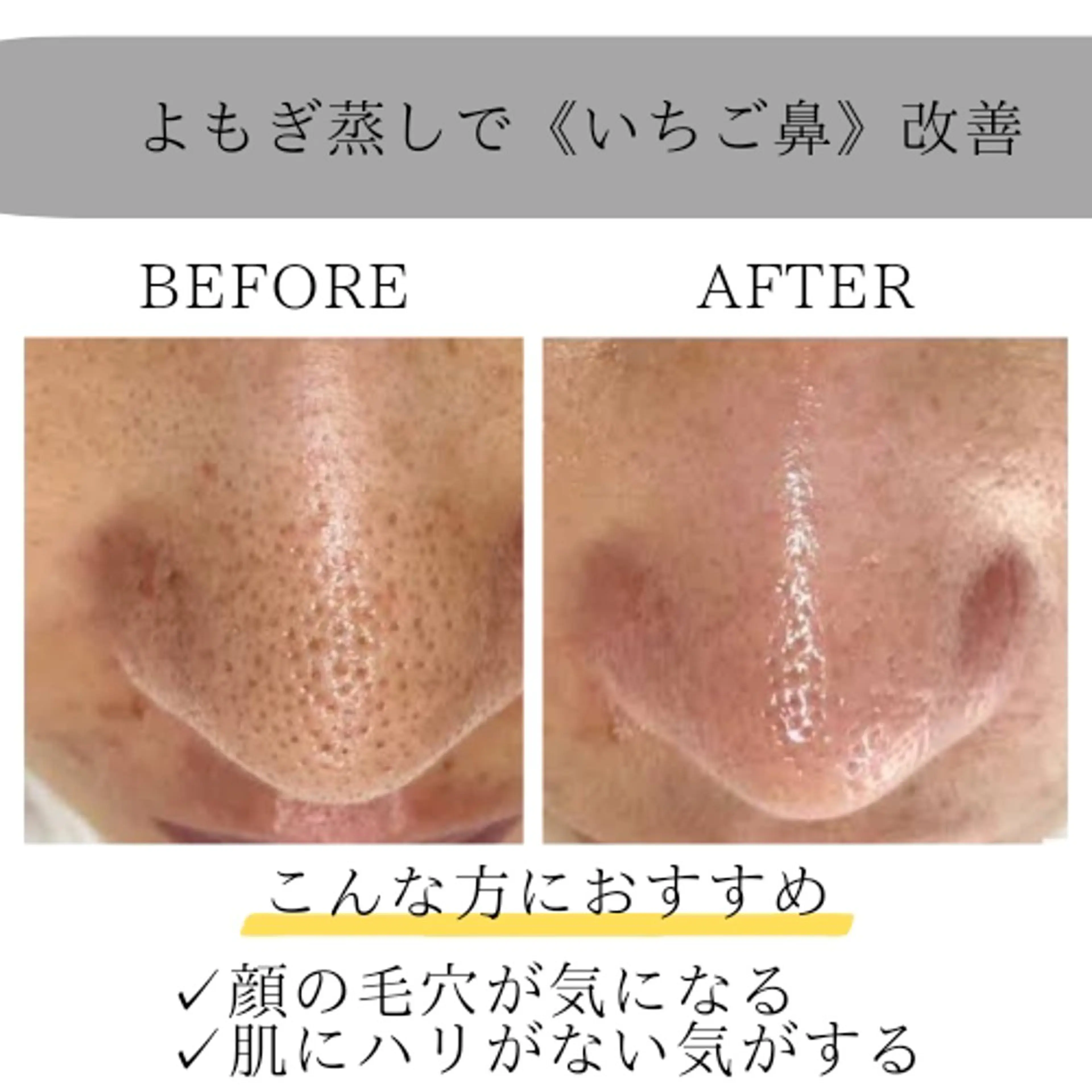 ホワイトニングサロン ネージュ(女性専用)のその他イメージ