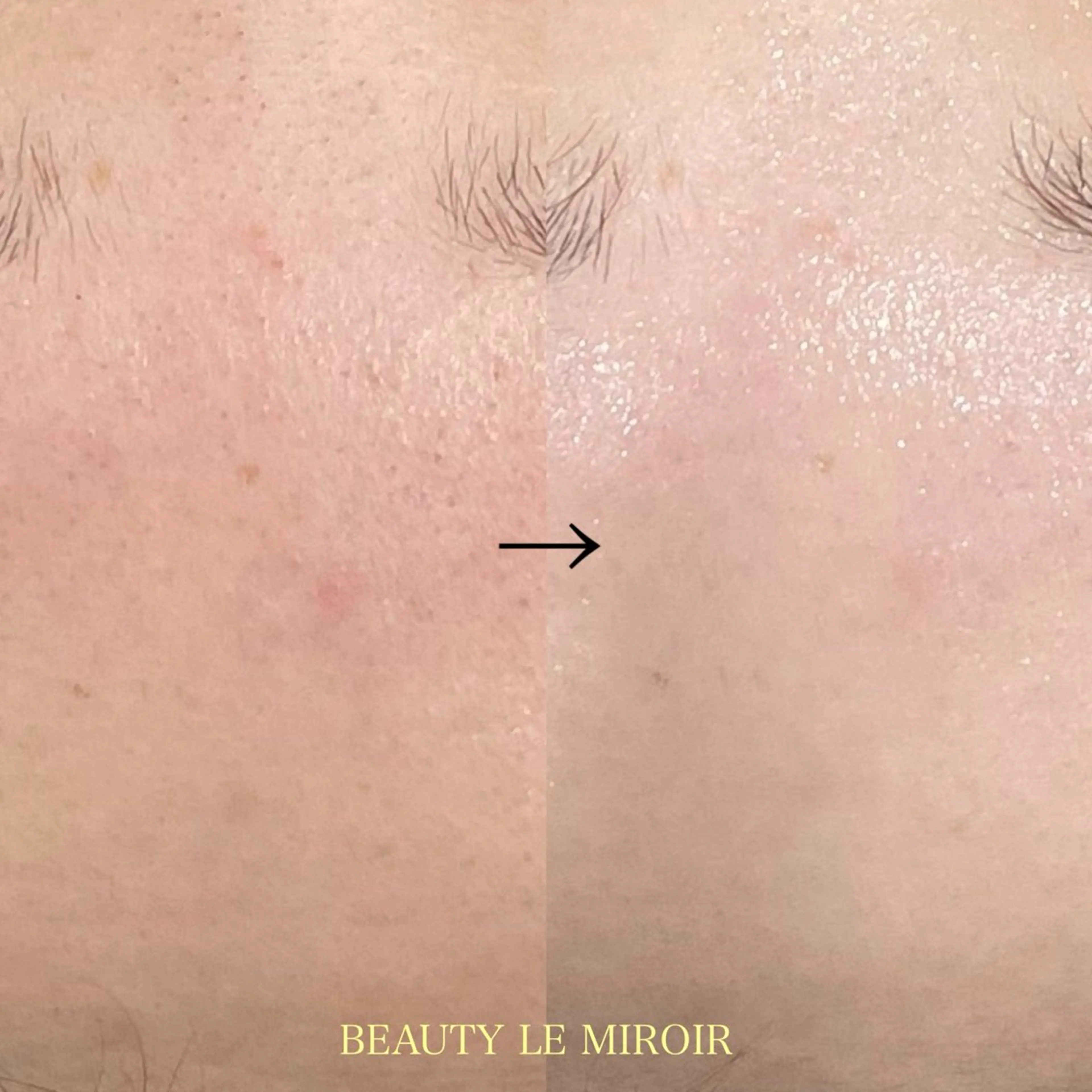 エステ ビューティー ミロワールのエステ・リラクイメージ