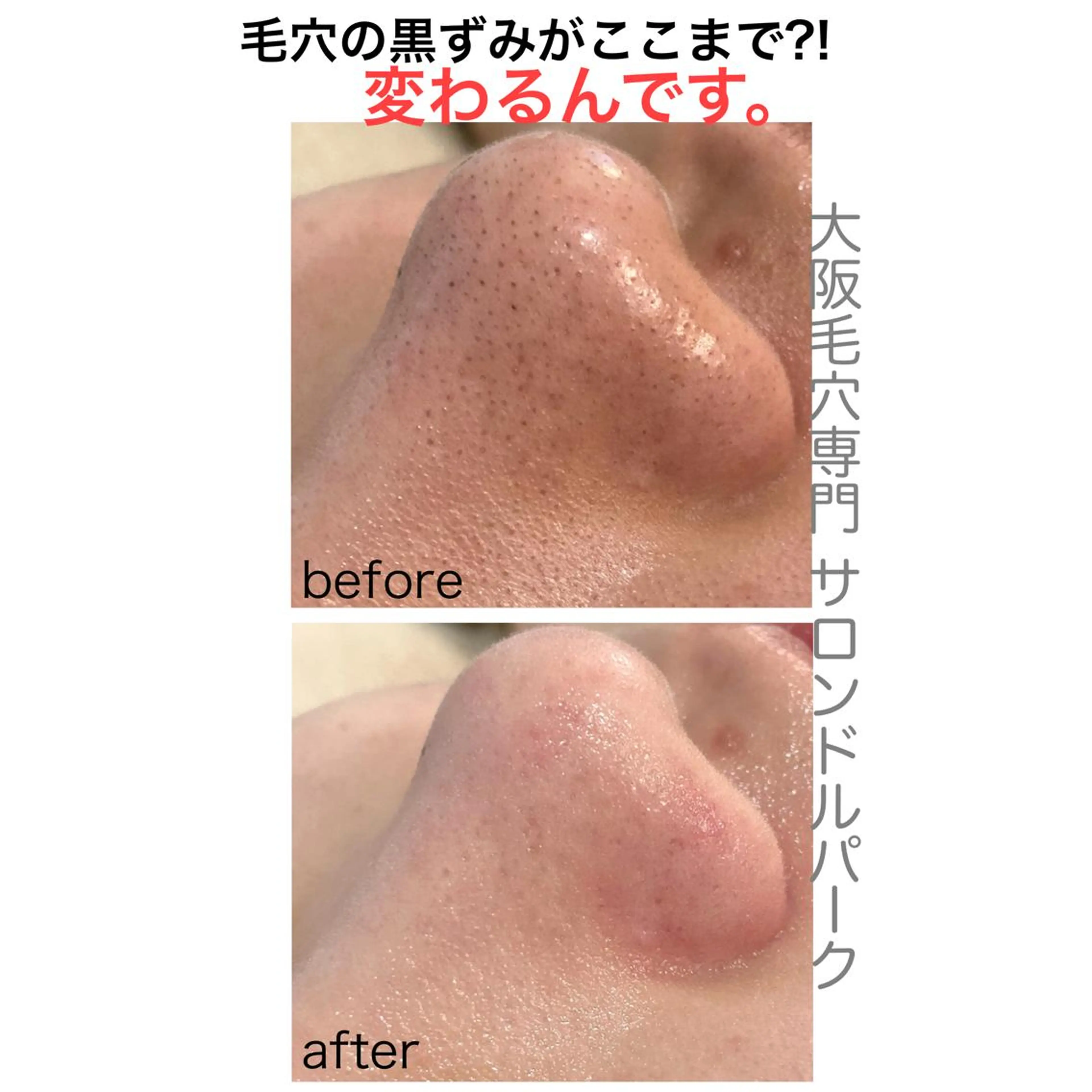 毛穴・シミ専門サロン ルパークのエステ・リラクイメージ