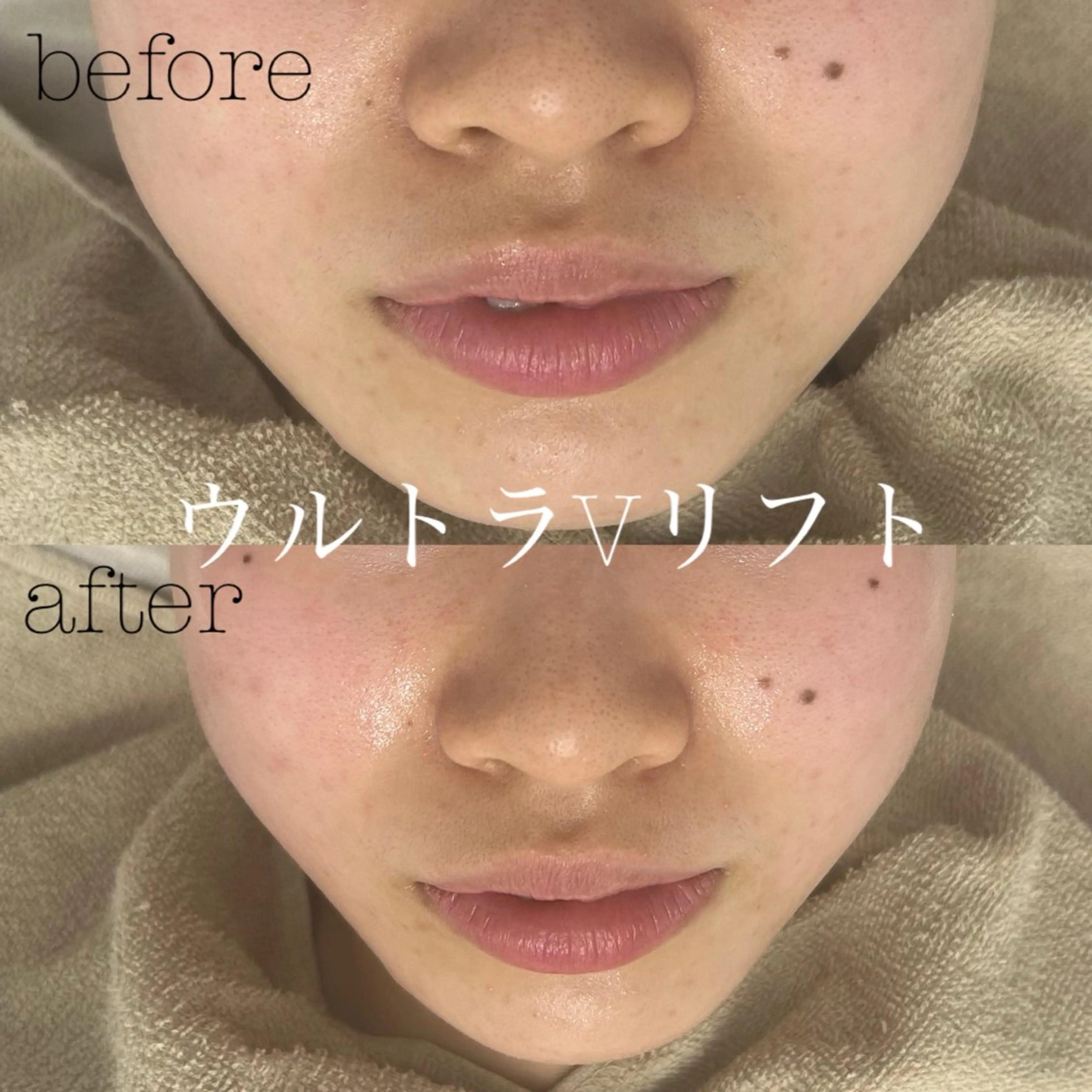 エステ フェイシャルサロン CHIARA 荒田のエステ・リラクイメージ