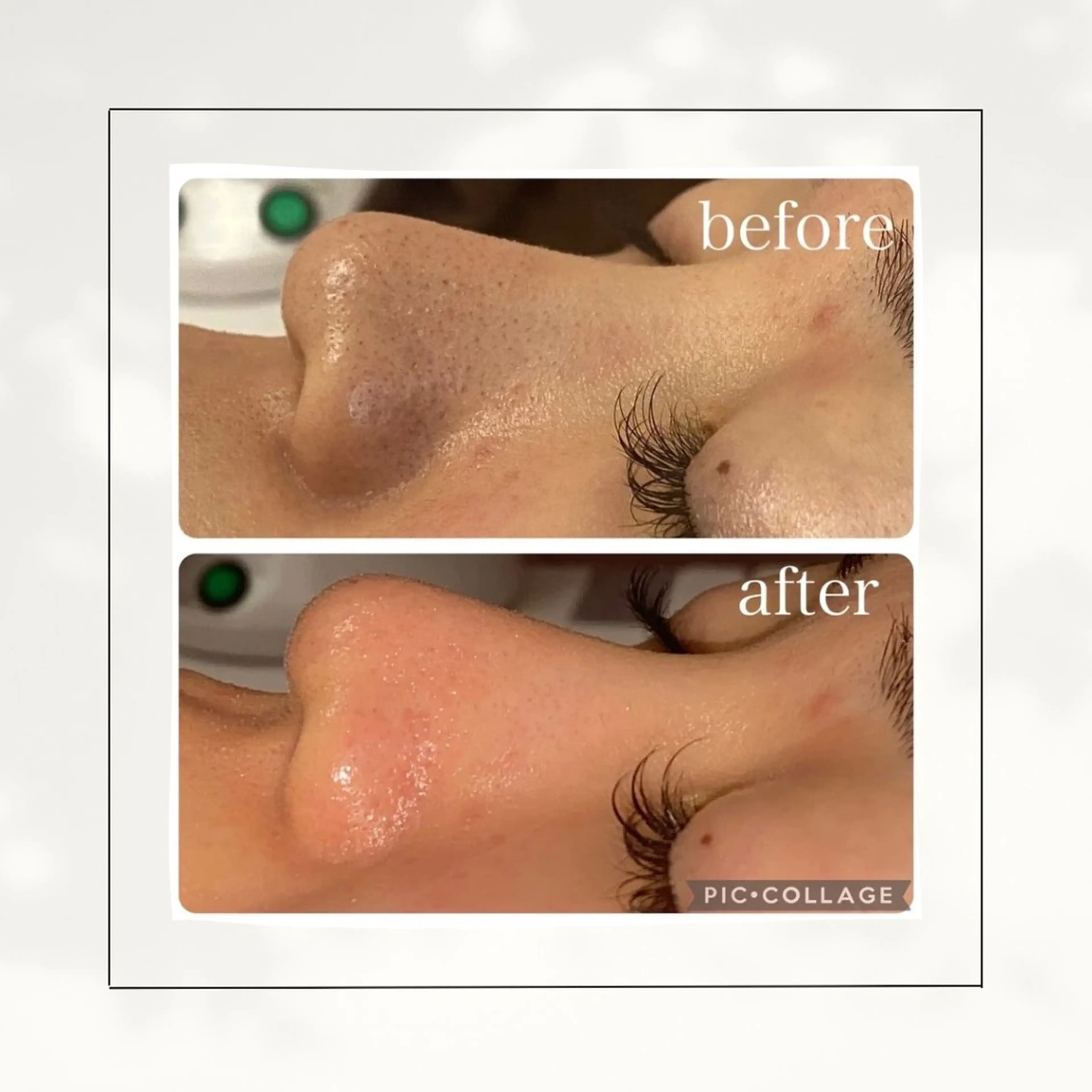 エステ シミ・毛穴専門店 /gracia 安藤のエステ・リラクイメージ