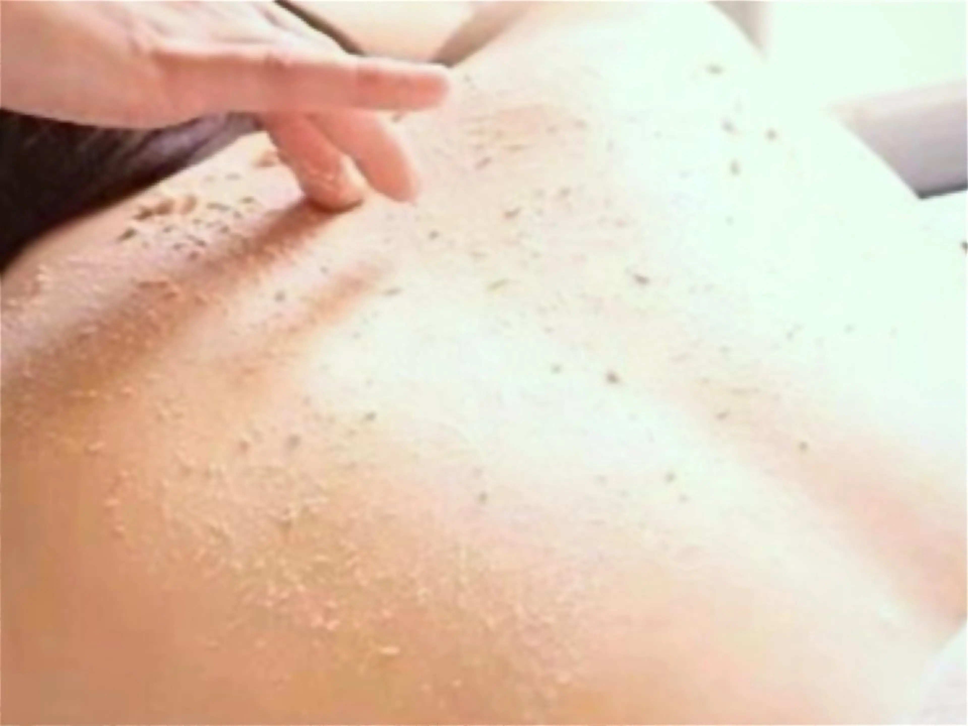 繰り返すニキビ・毛穴 ✨つくば肌質改善専門のエステ・リラクイメージ