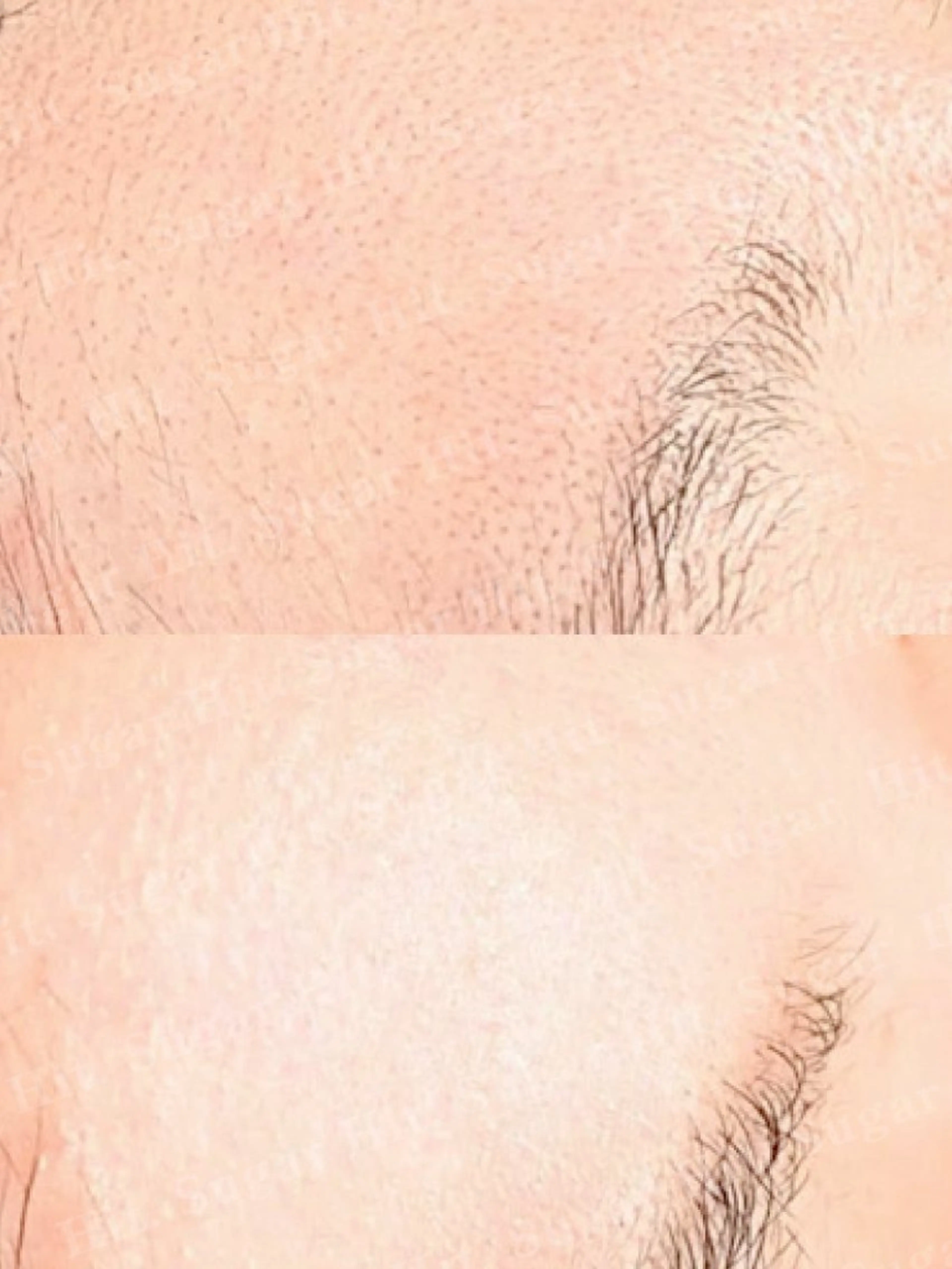 Hitomi シュガーリング豊橋のその他イメージ