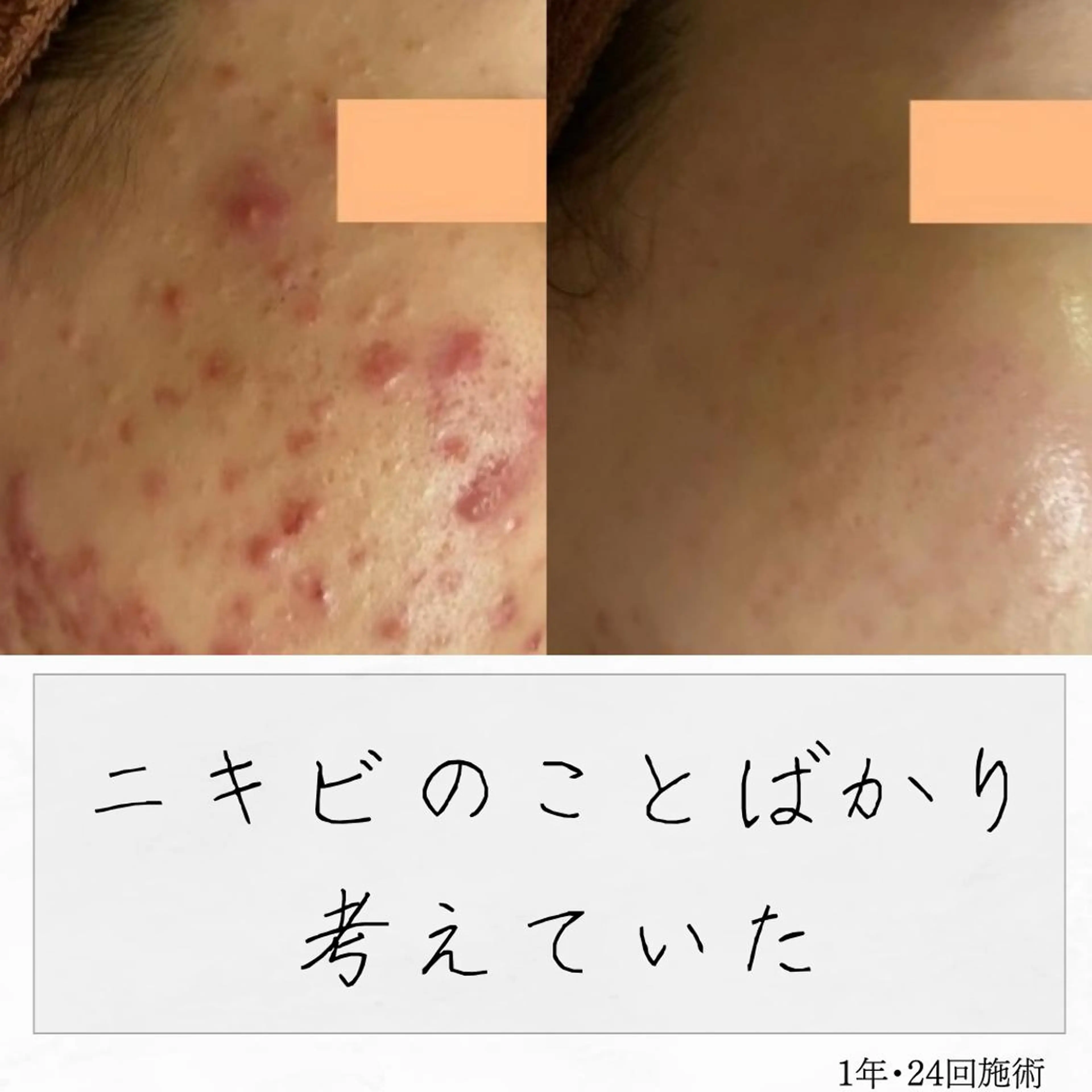 ニキビ経験者が施術 する専門サロン🌻のエステ・リラクイメージ