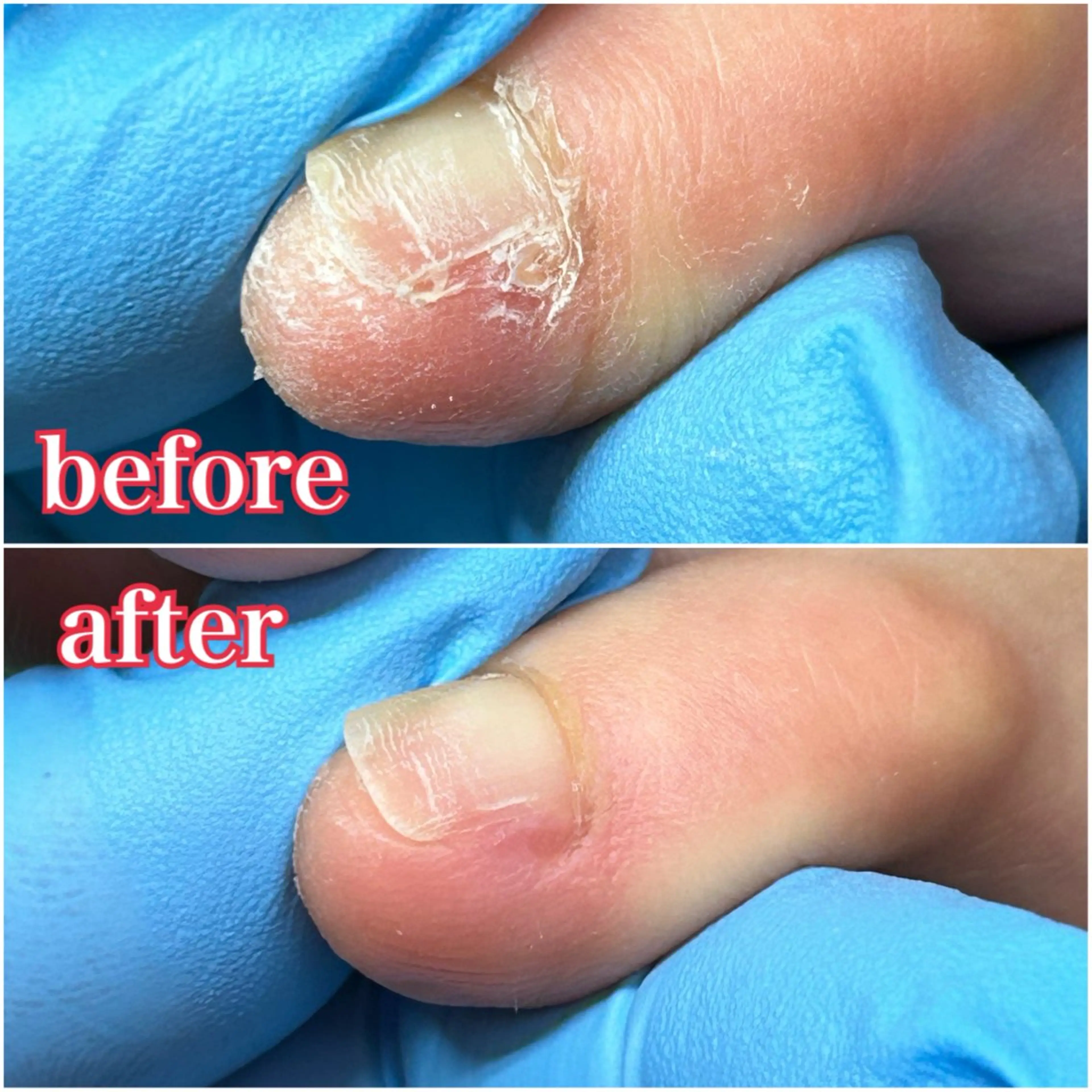 ネイル 巻き爪補正店 柏店のその他イメージ